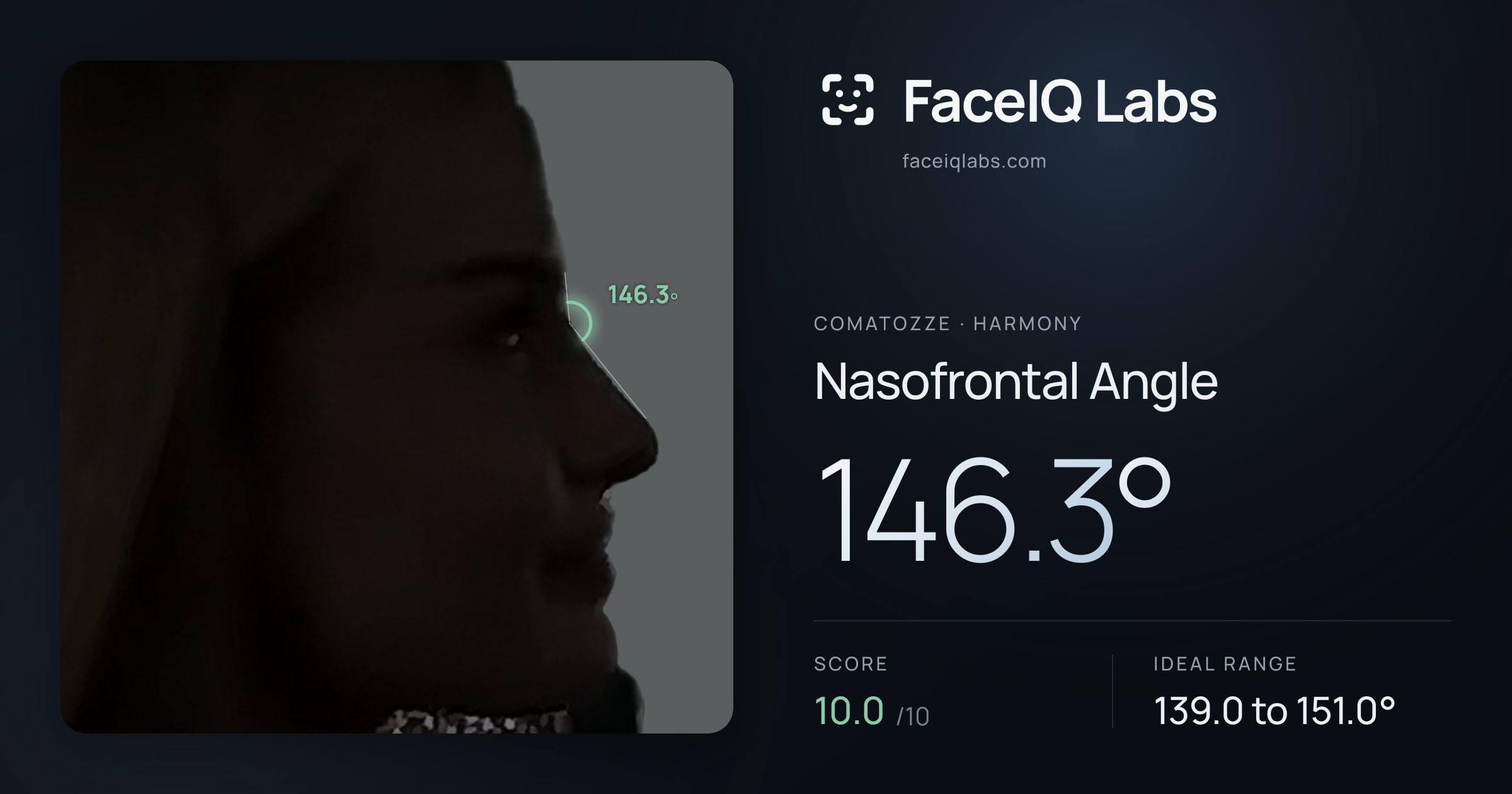 comatozze Nasofrontal Angle: 146.3°, drawn on the photo