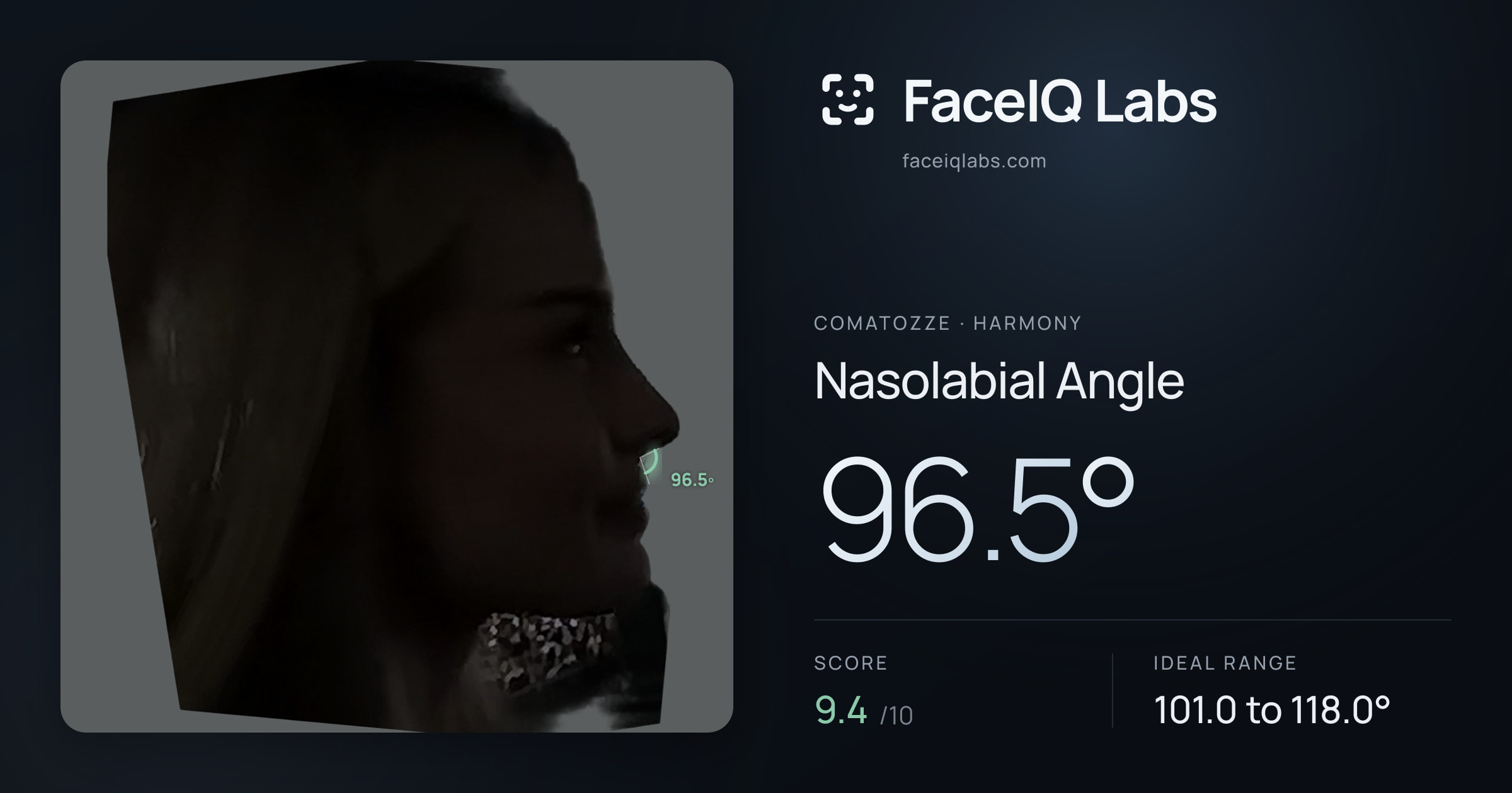 comatozze Nasolabial Angle: 96.5°, drawn on the photo