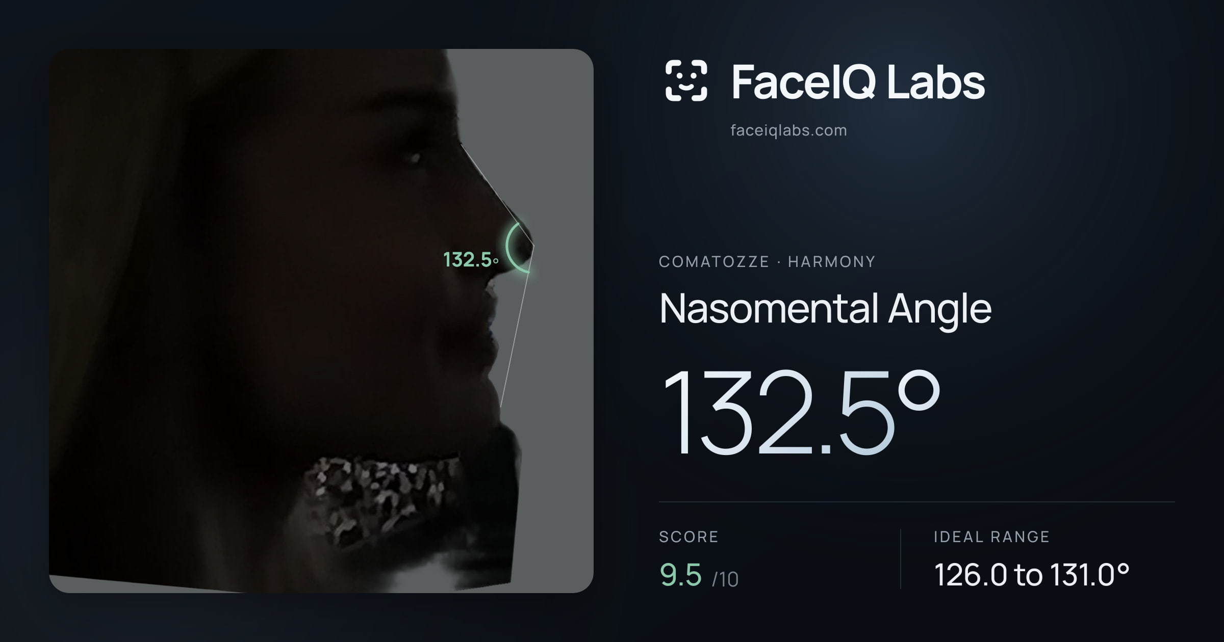 comatozze Nasomental Angle: 132.5°, drawn on the photo