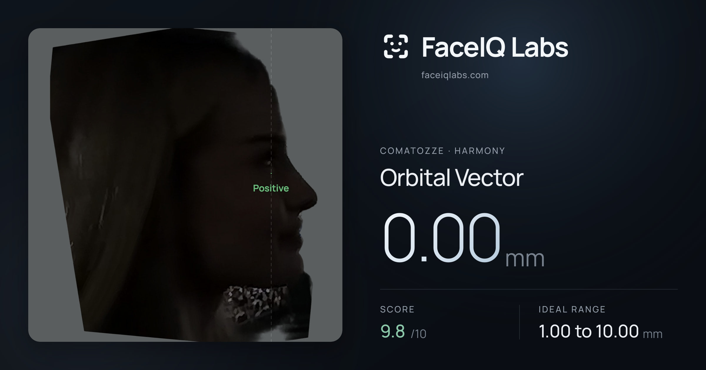 comatozze Orbital Vector: 0.00mm, drawn on the photo