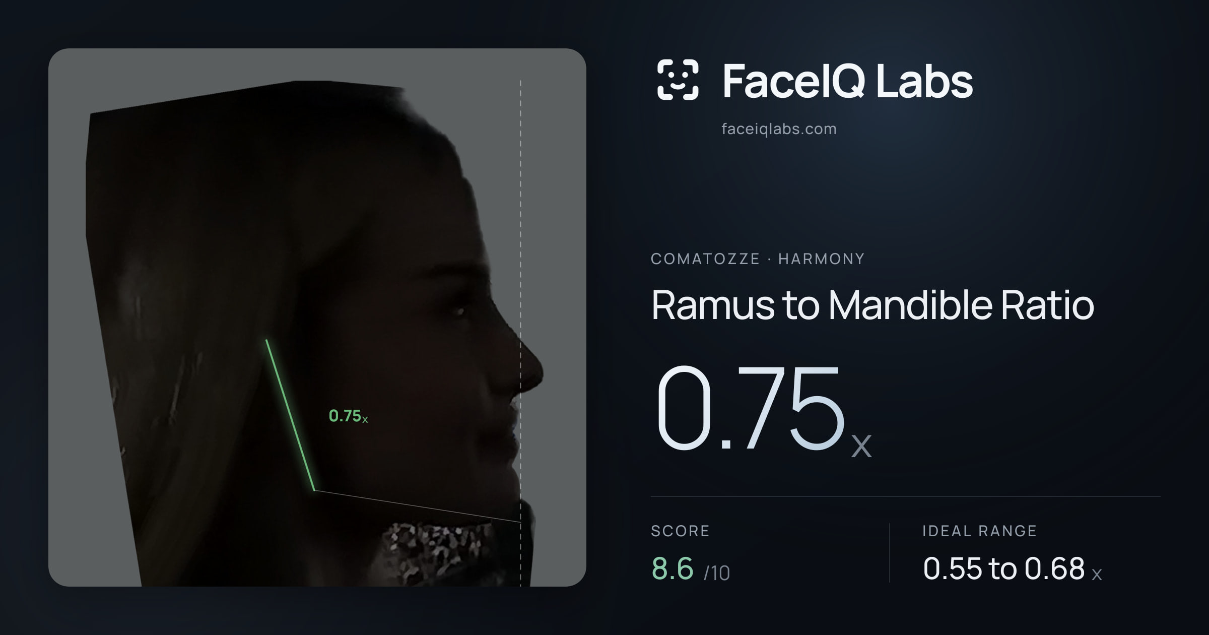 Comatozze Ramus to Mandible Ratio: 0.75x, drawn on the photo