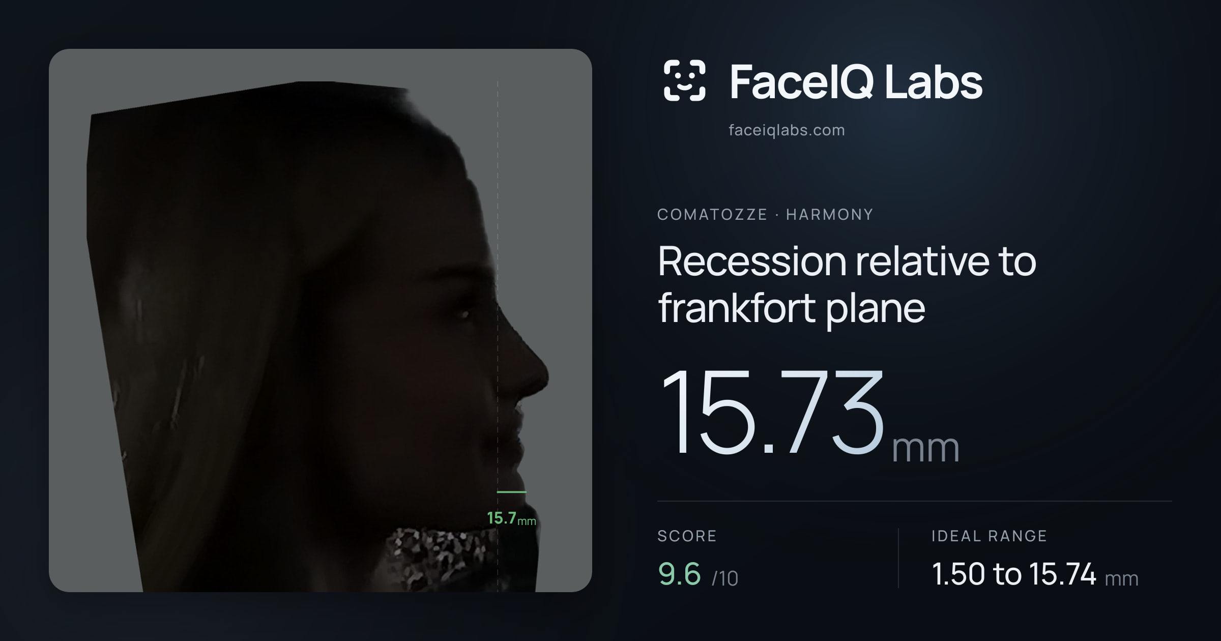 comatozze Recession relative to frankfort plane: 15.73mm, drawn on the photo