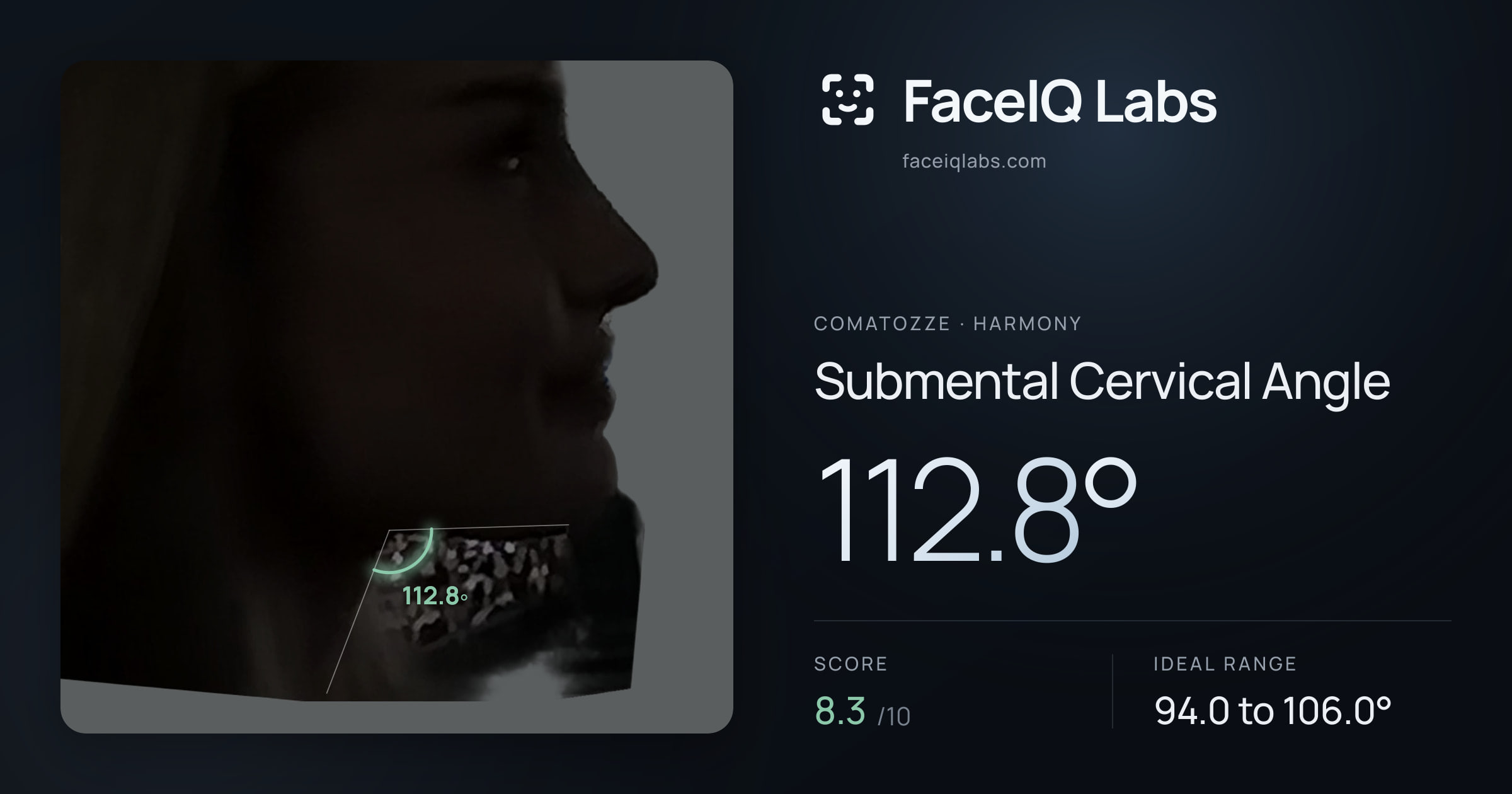 comatozze Submental Cervical Angle: 112.8°, drawn on the photo