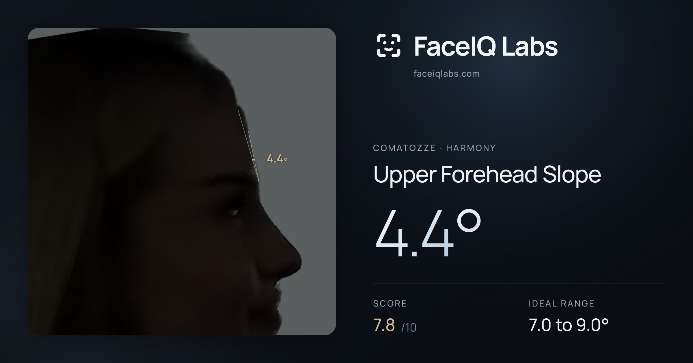 Comatozze Upper Forehead Slope: 4.4°, drawn on the photo
