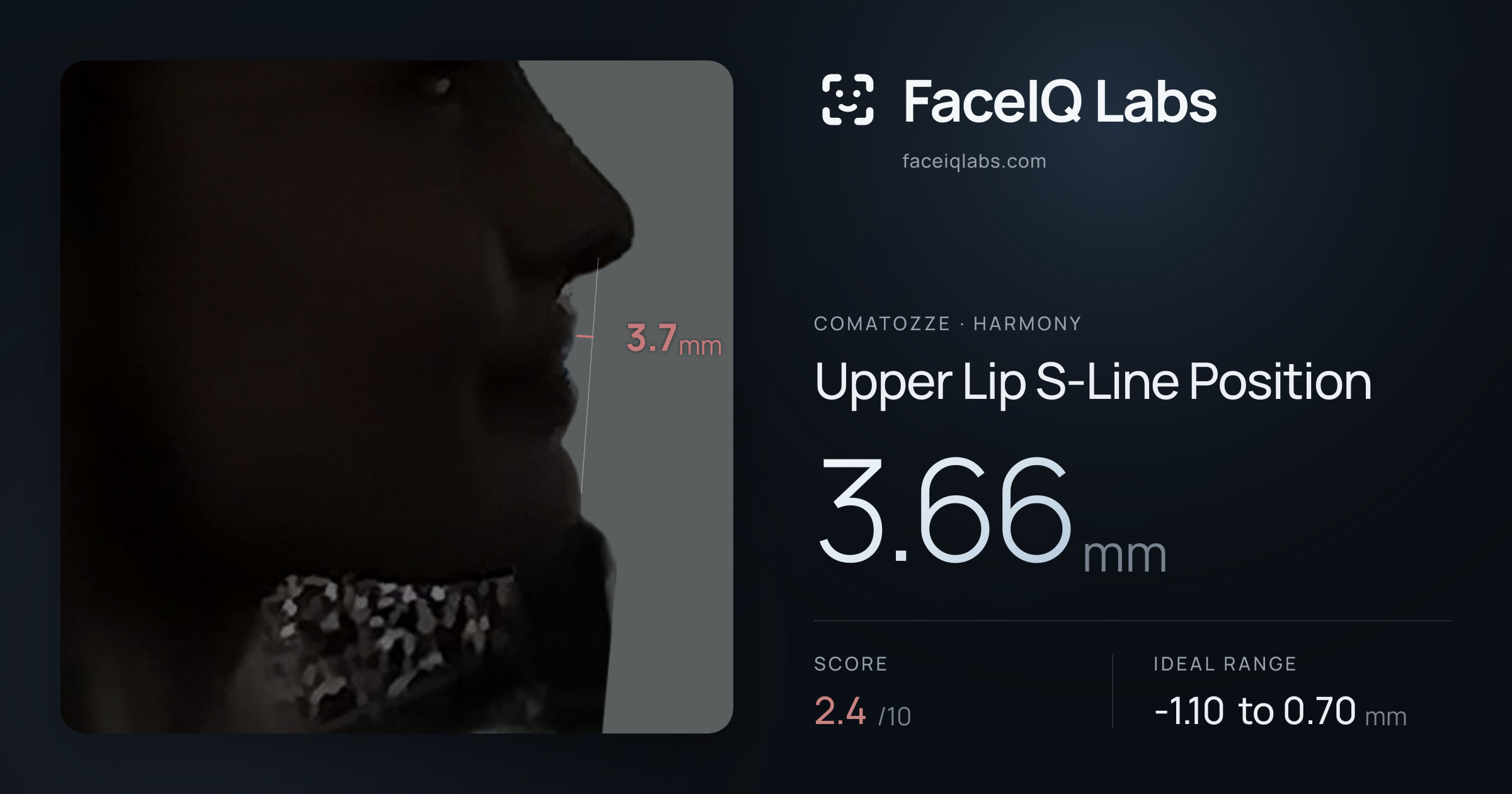 comatozze Upper Lip S-Line Position: 3.66mm, drawn on the photo