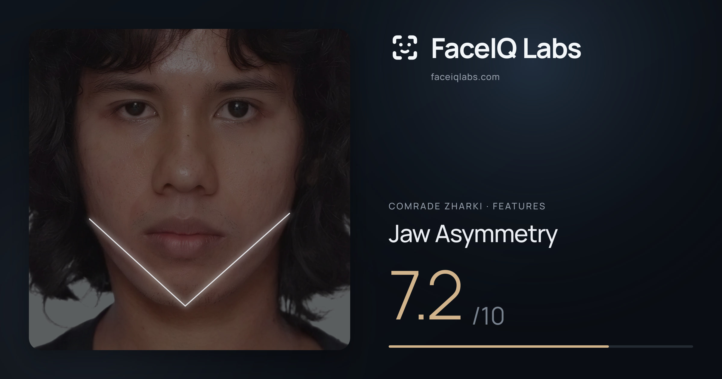 Comrade Zharki Jaw Asymmetry: 7.2/10, drawn on the photo