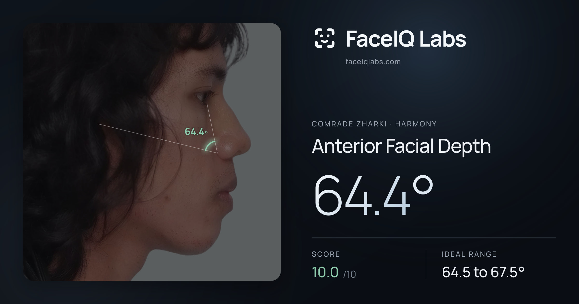 Comrade Zharki Anterior Facial Depth: 64.4°, drawn on the photo