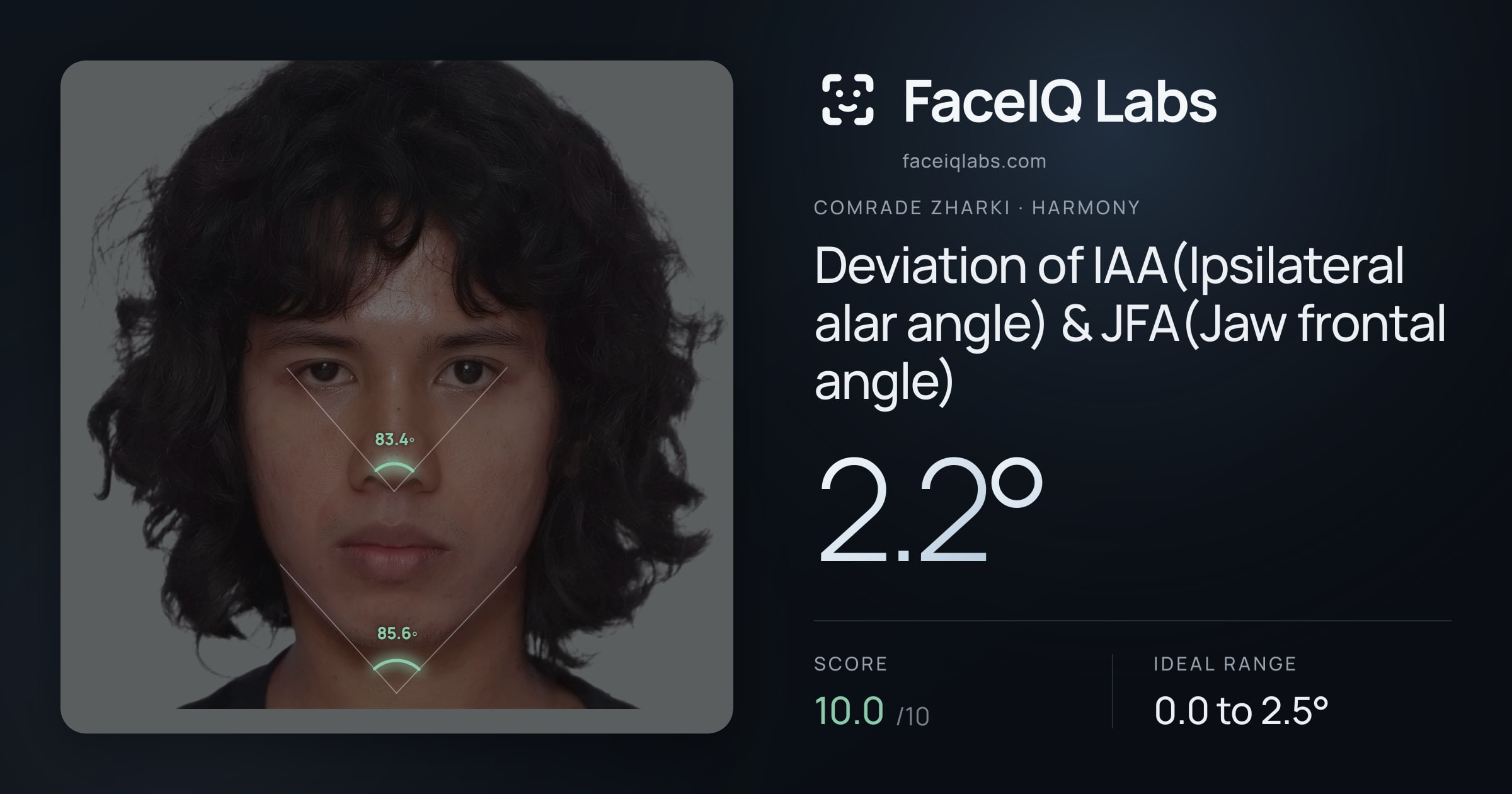 Comrade Zharki Deviation of IAA(Ipsilateral alar angle) & JFA(Jaw frontal angle): 2.2°, drawn on the photo