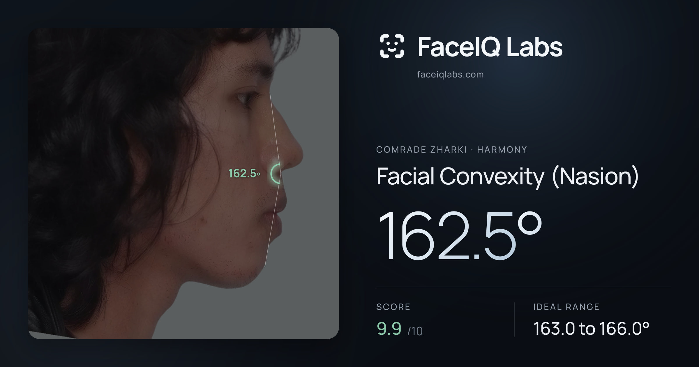 Comrade Zharki Facial Convexity (Nasion): 162.5°, drawn on the photo