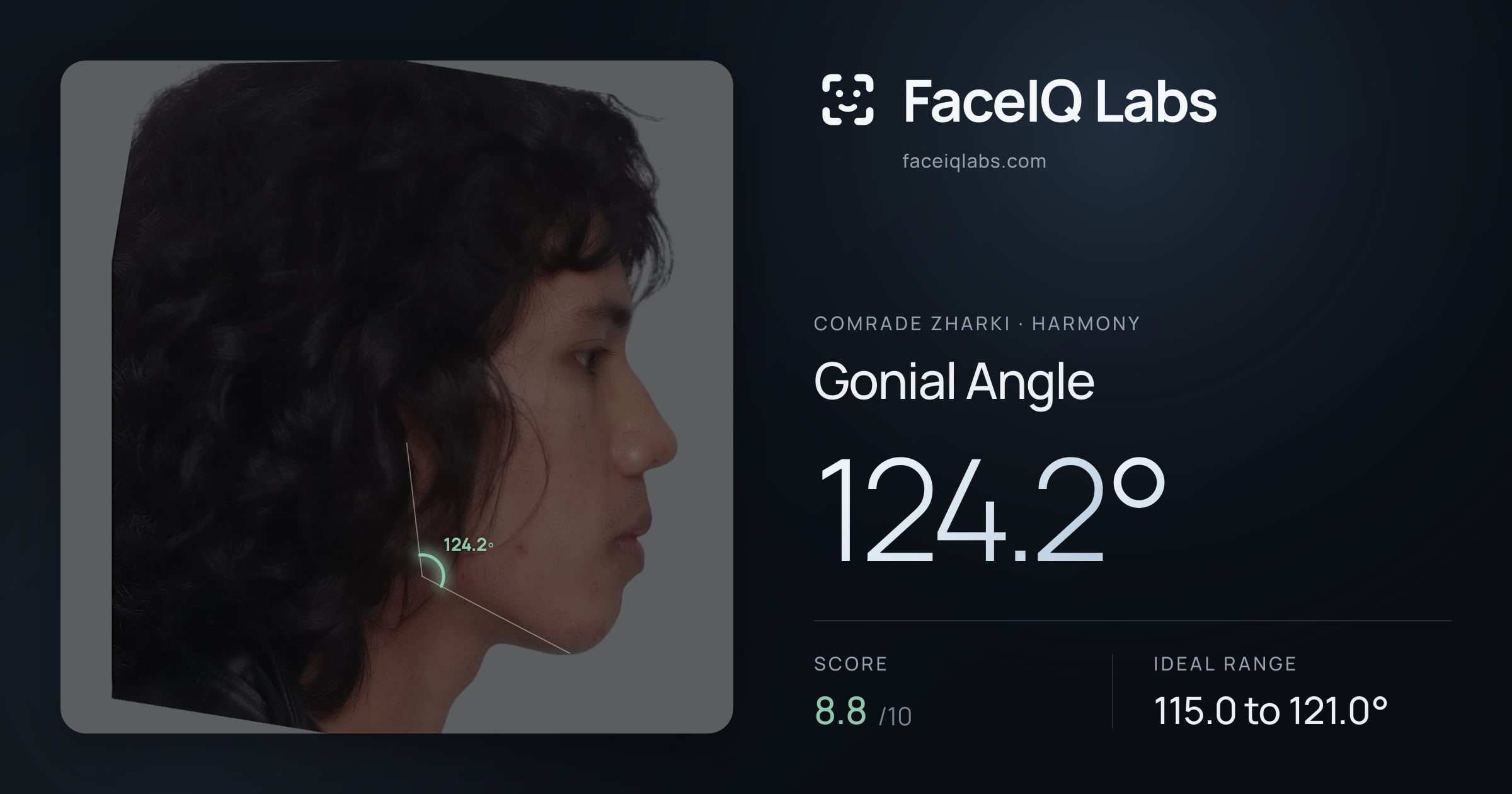 Comrade Zharki Gonial Angle: 124.2°, drawn on the photo