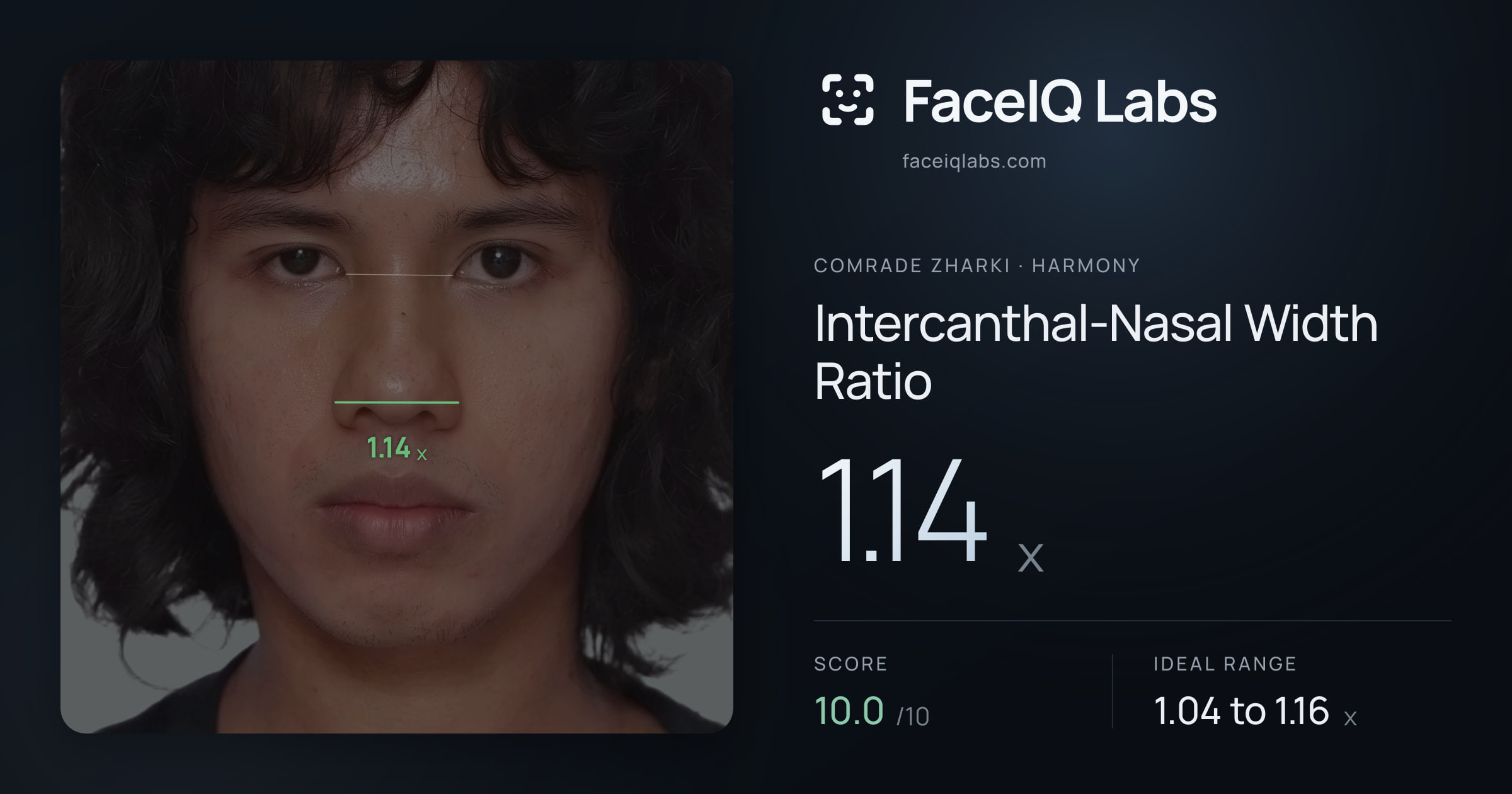 Comrade Zharki Intercanthal-Nasal Width Ratio: 1.14x, drawn on the photo