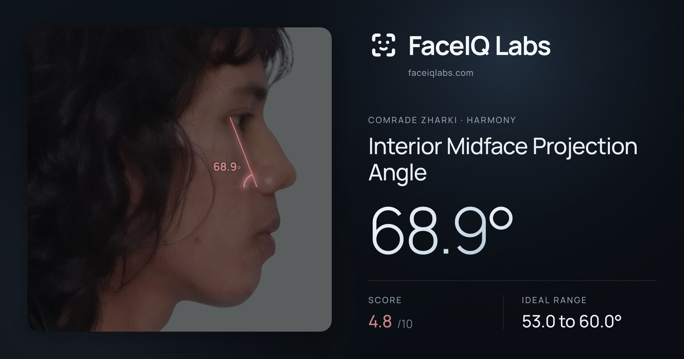 Comrade Zharki Interior Midface Projection Angle: 68.9°, drawn on the photo