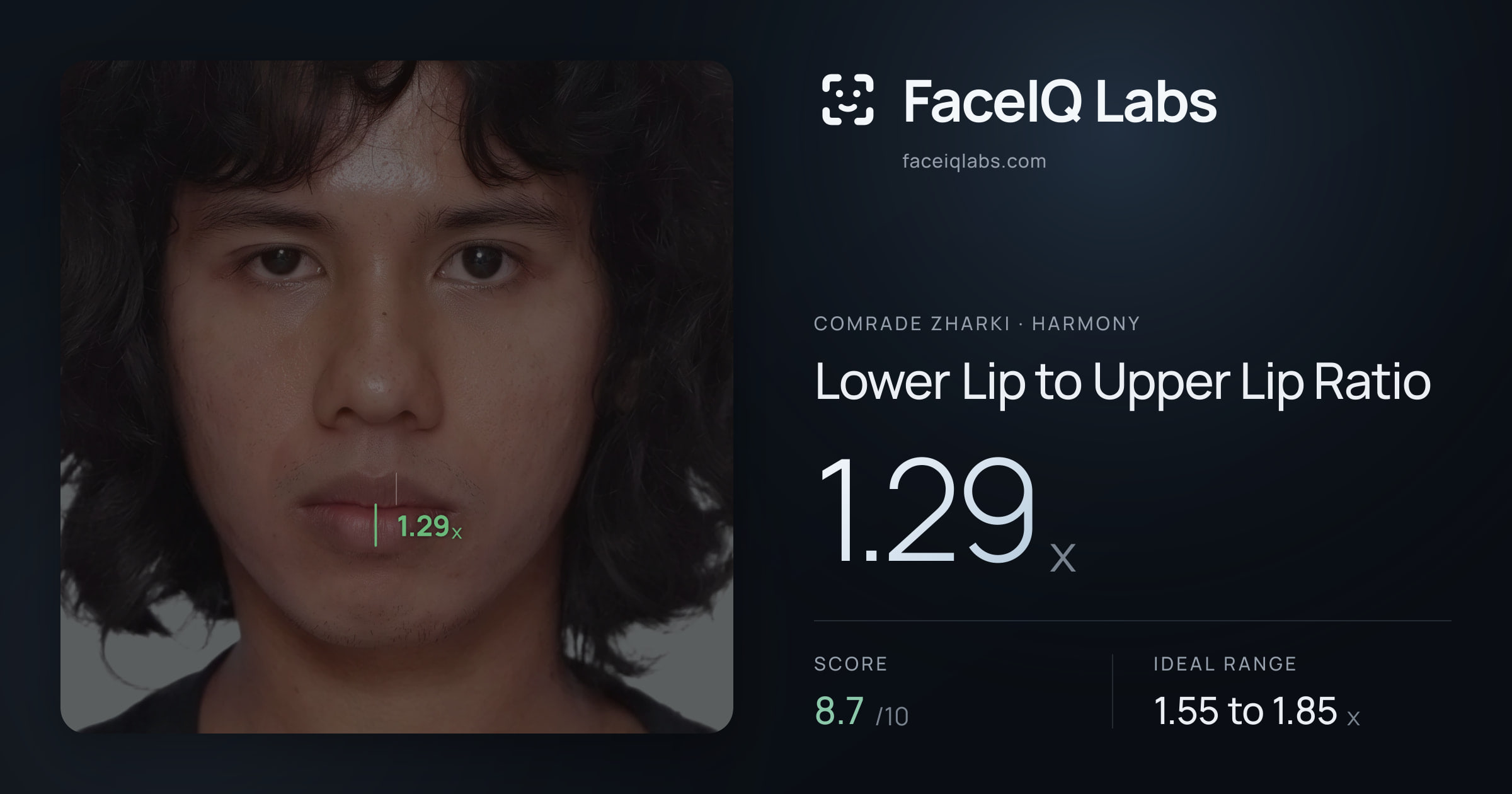 Comrade Zharki Lower Lip to Upper Lip Ratio: 1.29x, drawn on the photo