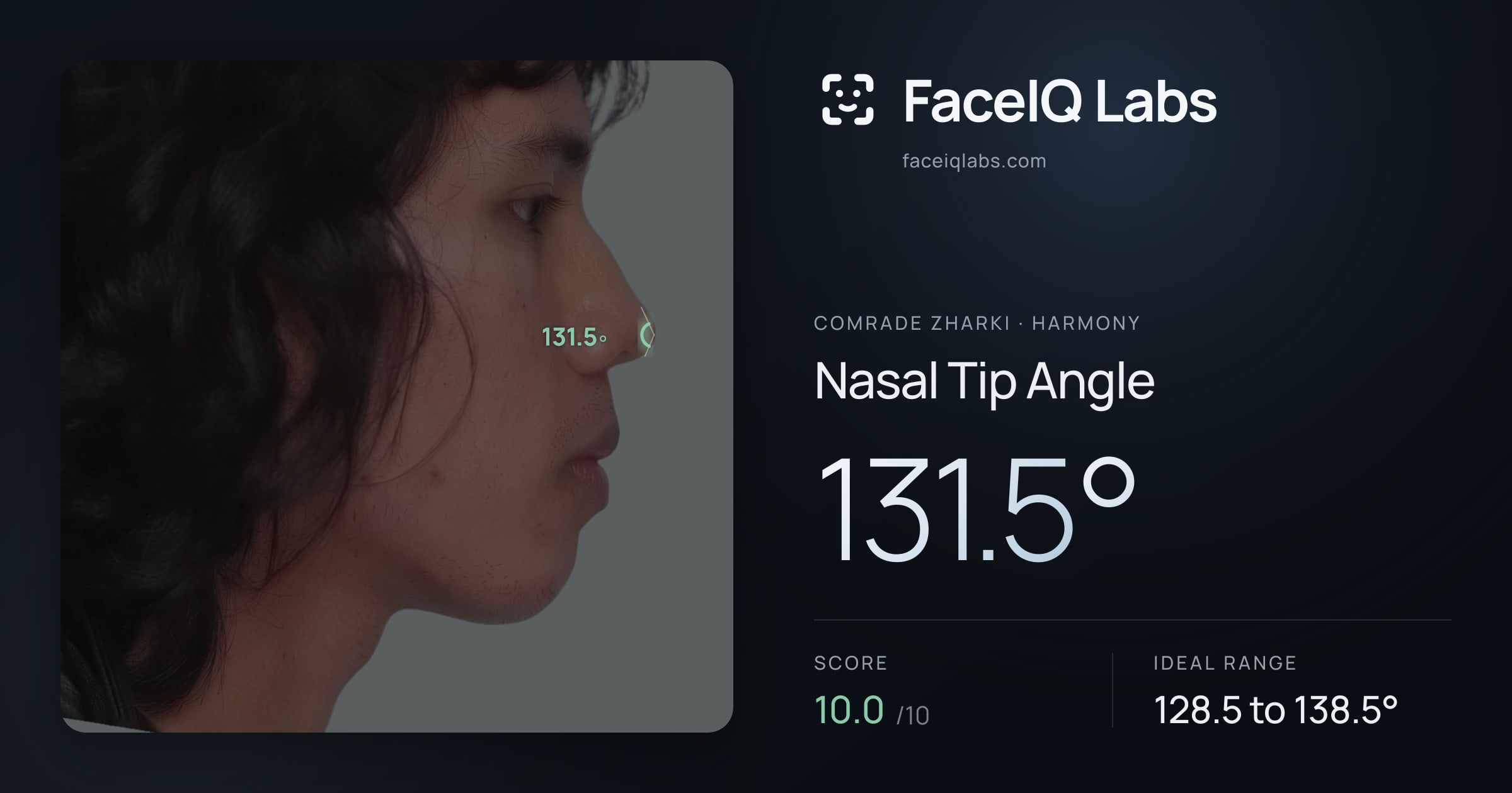 Comrade Zharki Nasal Tip Angle: 131.5°, drawn on the photo