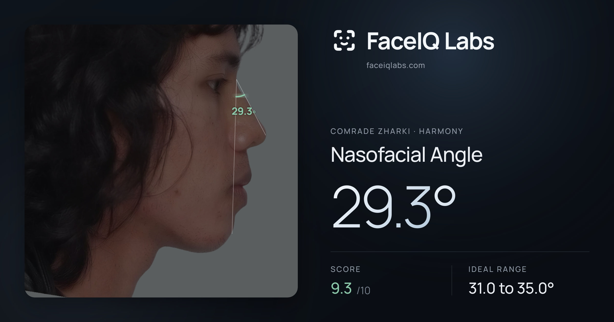 Comrade Zharki Nasofacial Angle: 29.3°, drawn on the photo