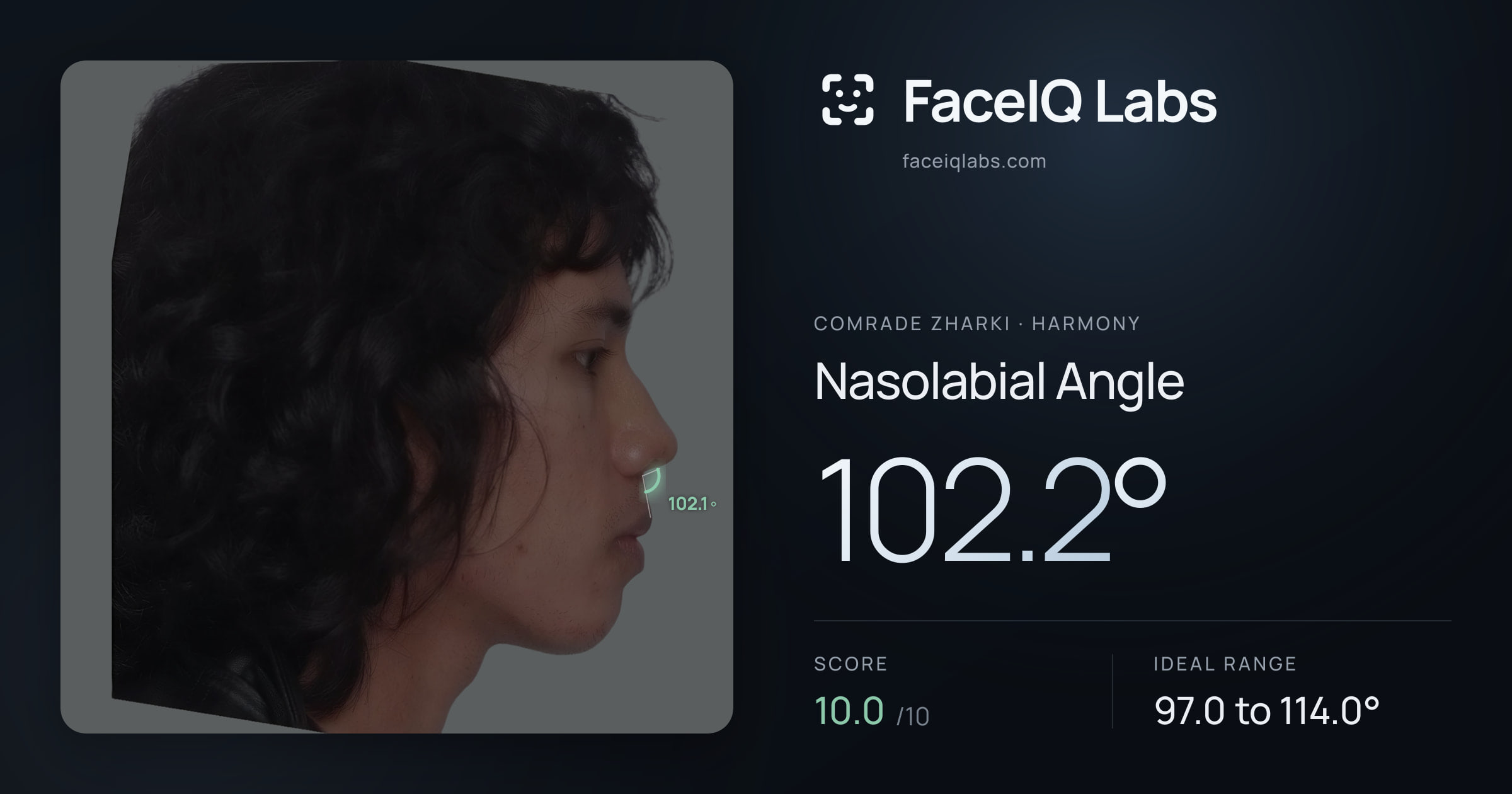 Comrade Zharki Nasolabial Angle: 102.2°, drawn on the photo
