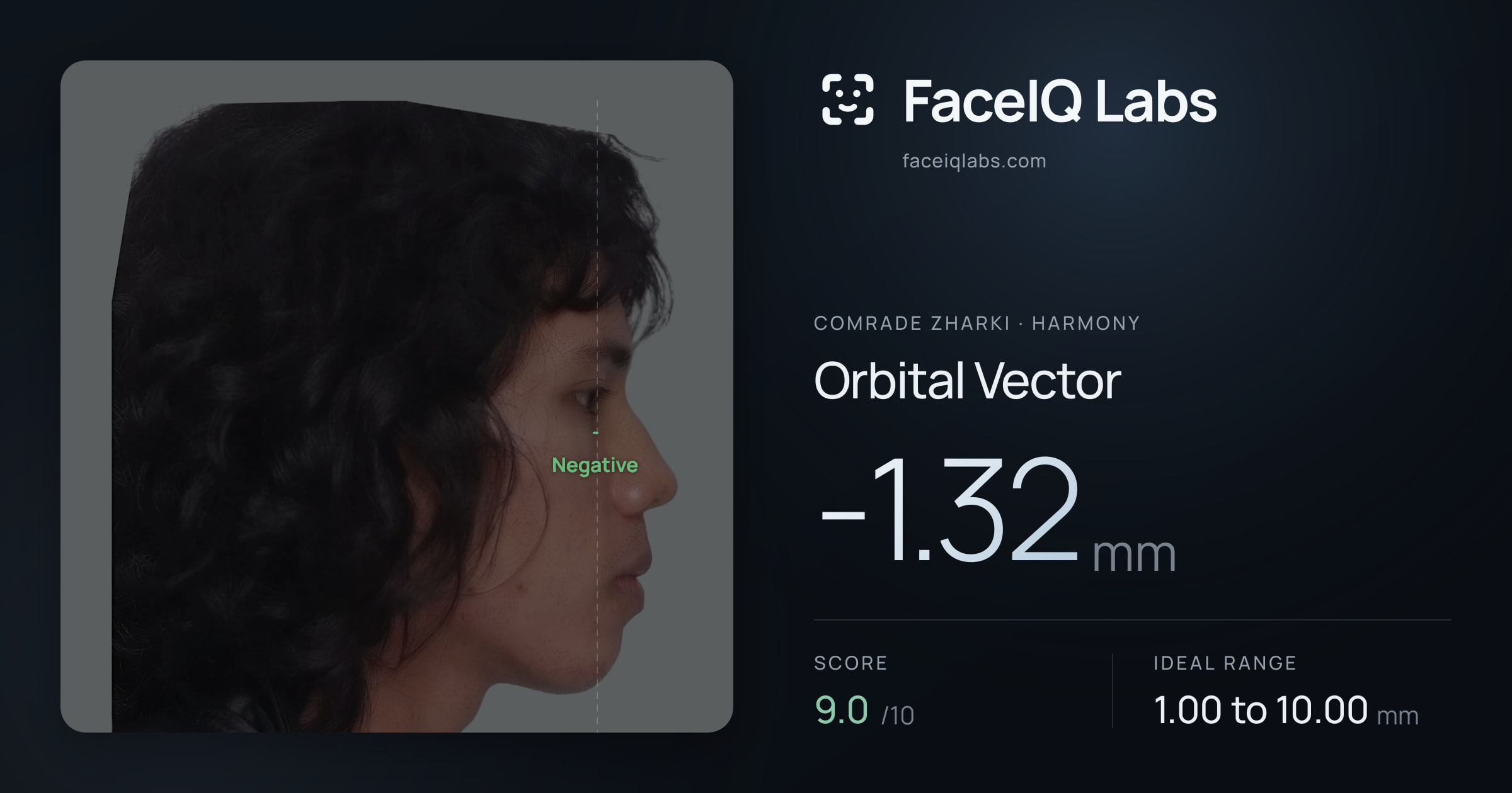 Comrade Zharki Orbital Vector: -1.32mm, drawn on the photo