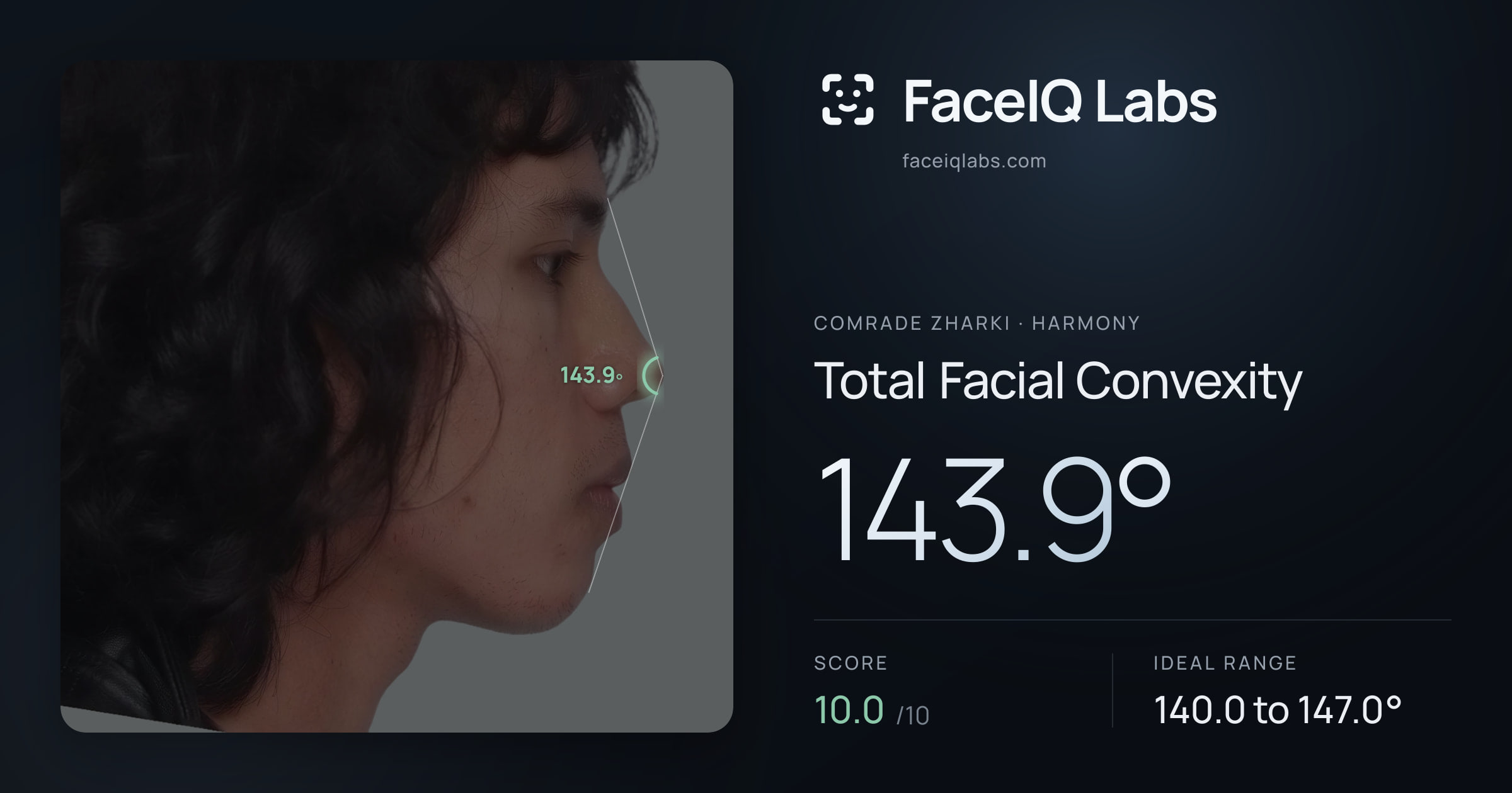 Comrade Zharki Total Facial Convexity: 143.9°, drawn on the photo