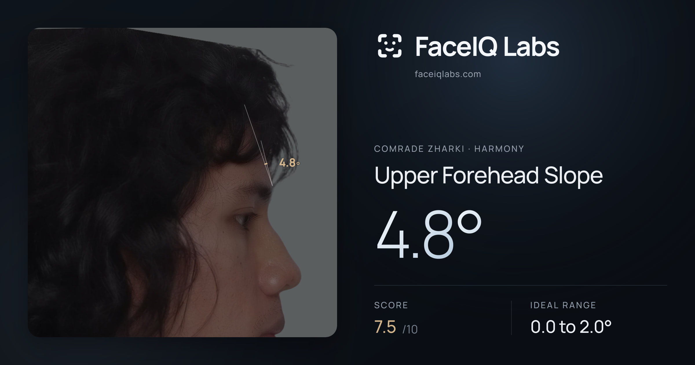 Comrade Zharki Upper Forehead Slope: 4.8°, drawn on the photo