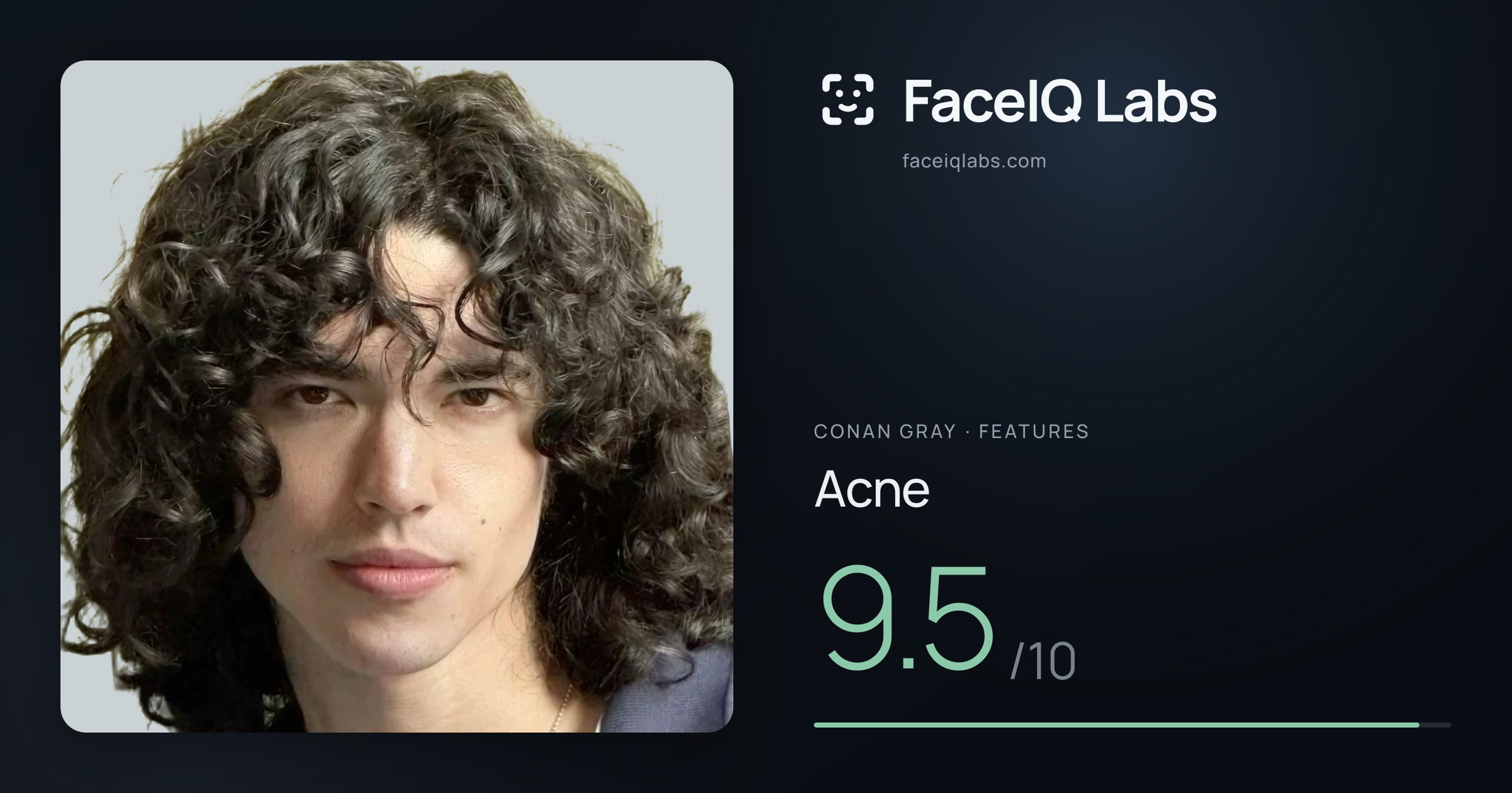 Conan Gray Acne: 9.5/10, drawn on the photo