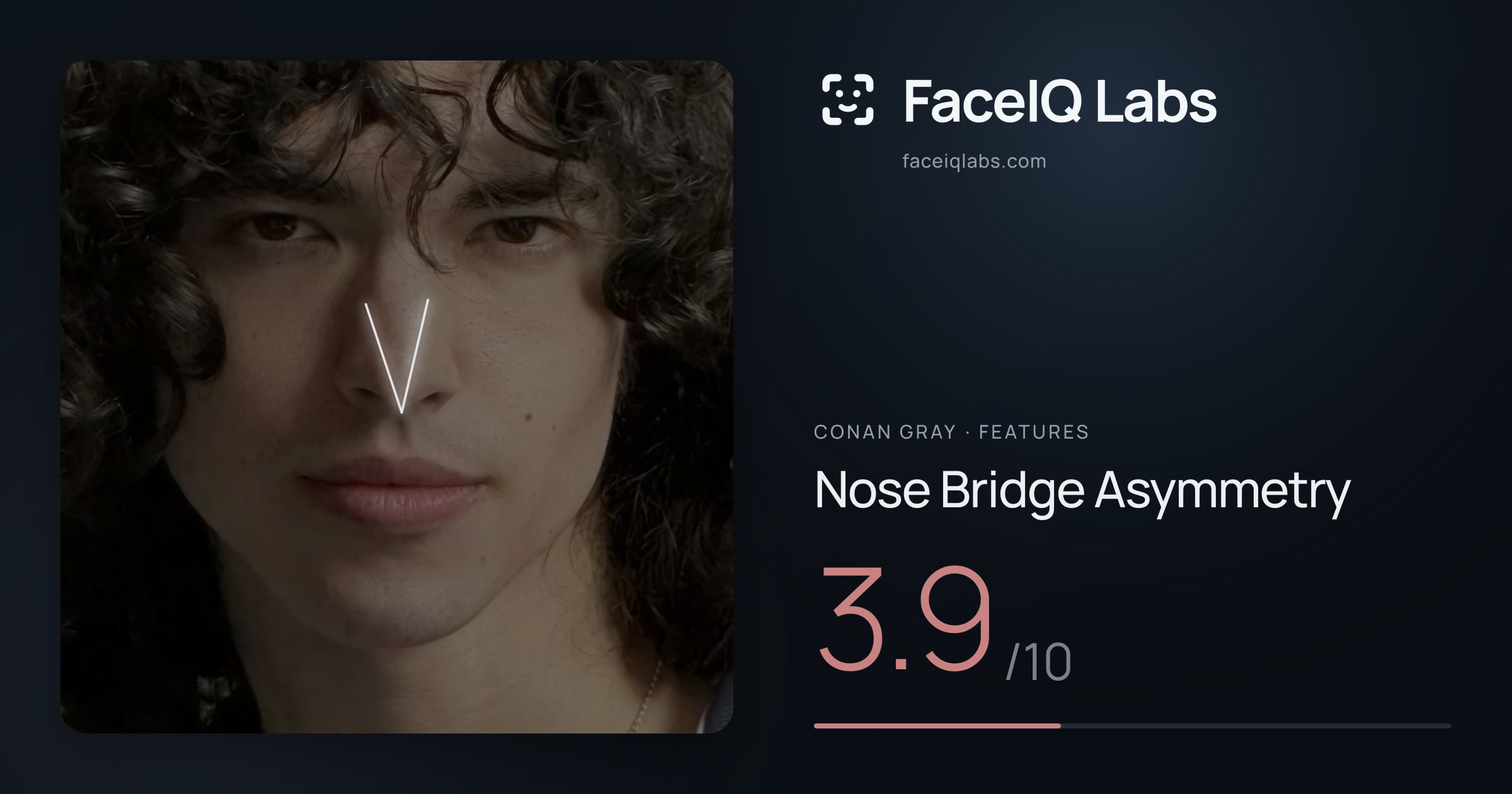 Conan Gray Nose Bridge Asymmetry: 3.9/10, drawn on the photo