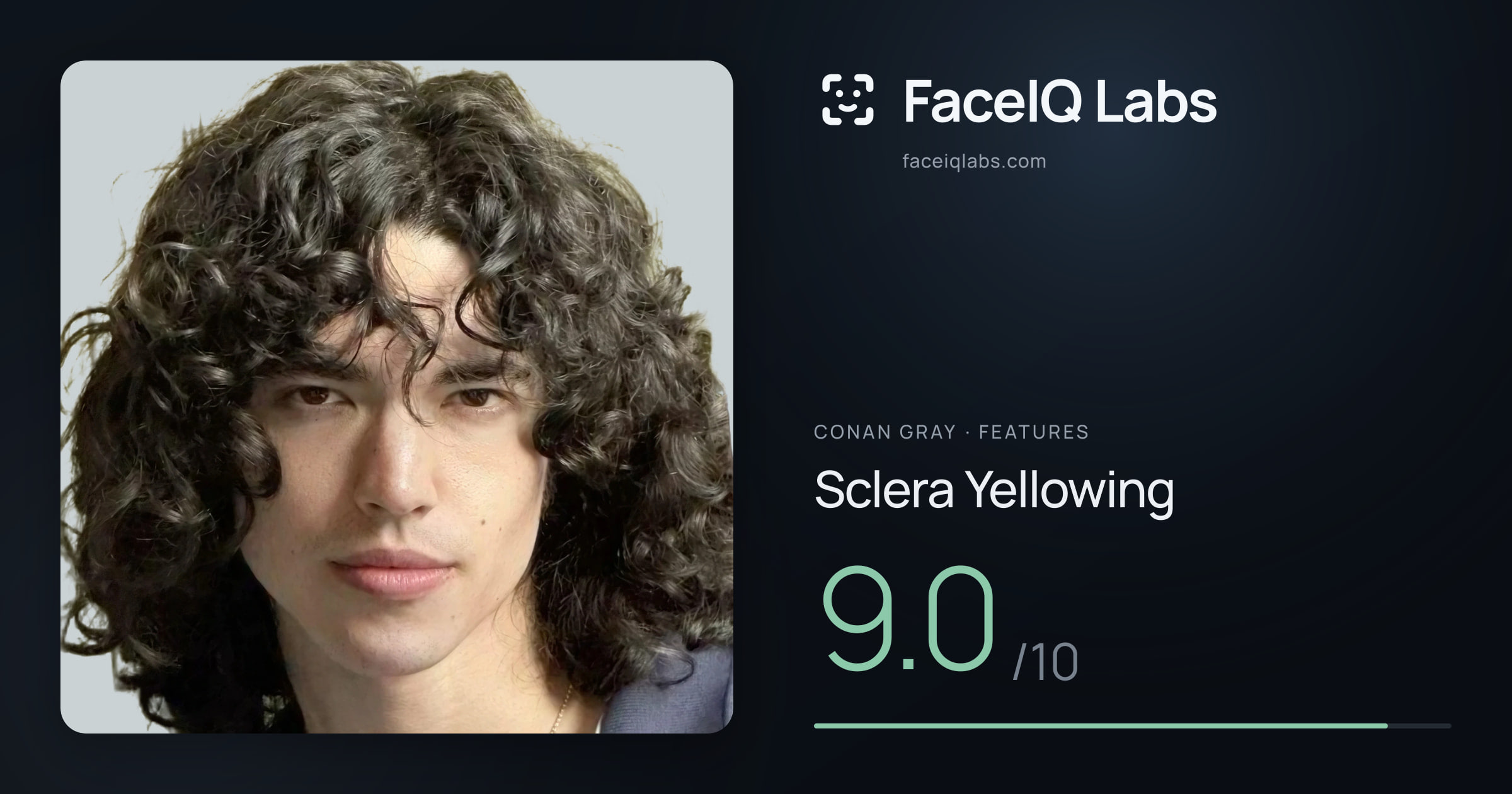 Conan Gray Sclera Yellowing: 9.0/10, drawn on the photo