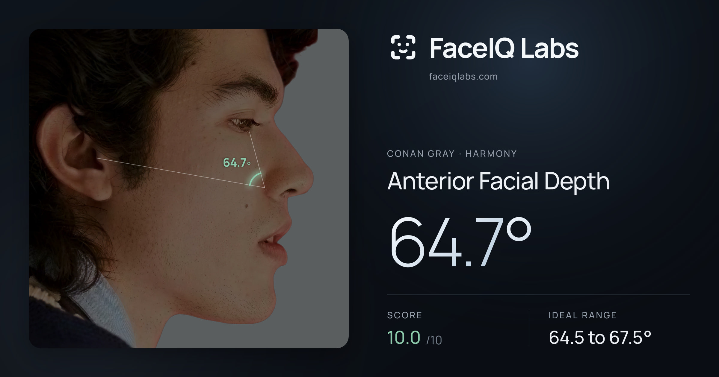 Conan Gray Anterior Facial Depth: 64.7°, drawn on the photo