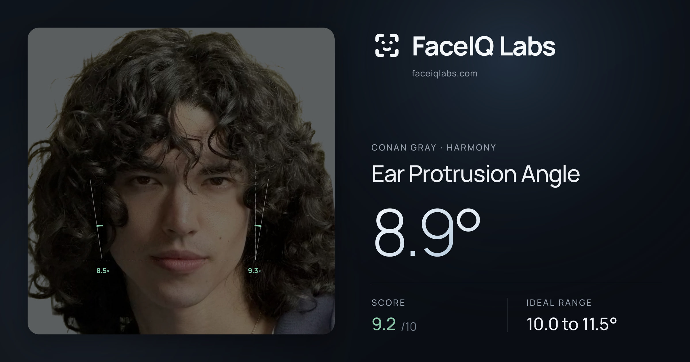 Conan Gray Ear Protrusion Angle: 8.9°, drawn on the photo