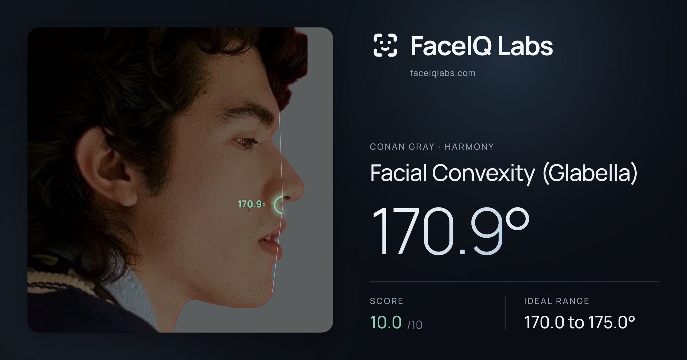 Conan Gray Facial Convexity (Glabella): 170.9°, drawn on the photo
