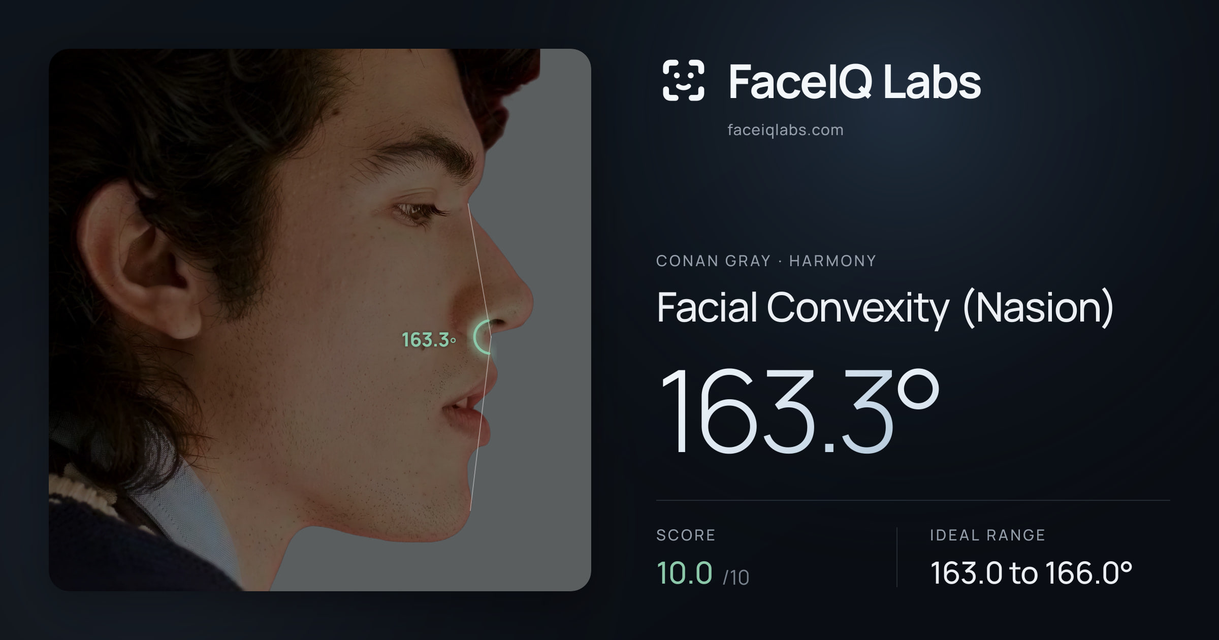 Conan Gray Facial Convexity (Nasion): 163.3°, drawn on the photo