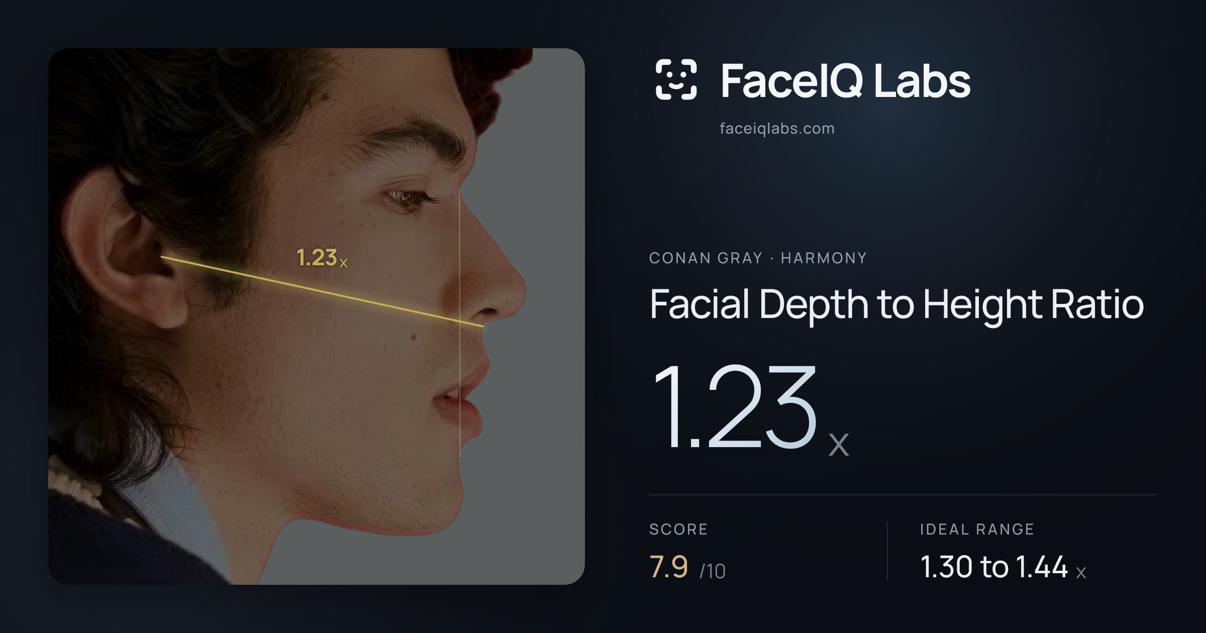 Conan Gray Facial Depth to Height Ratio: 1.23x, drawn on the photo