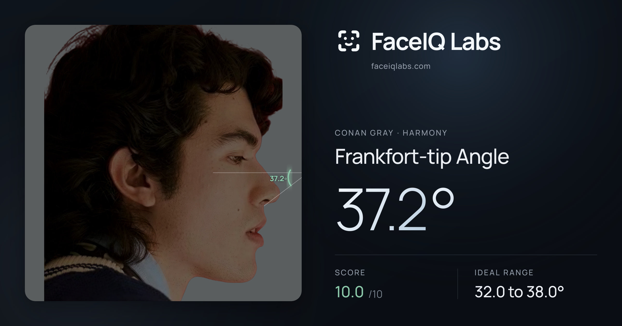Conan Gray Frankfort-tip Angle: 37.2°, drawn on the photo