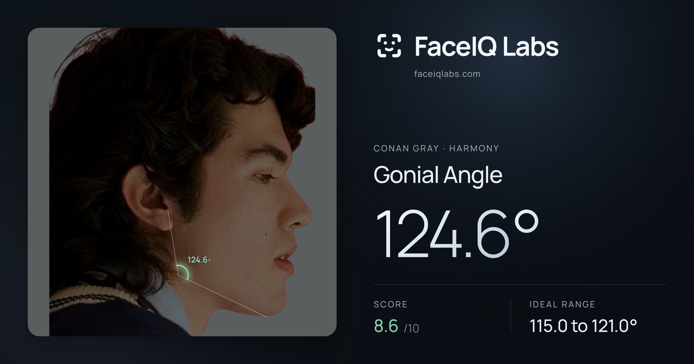 Conan Gray Gonial Angle: 124.6°, drawn on the photo