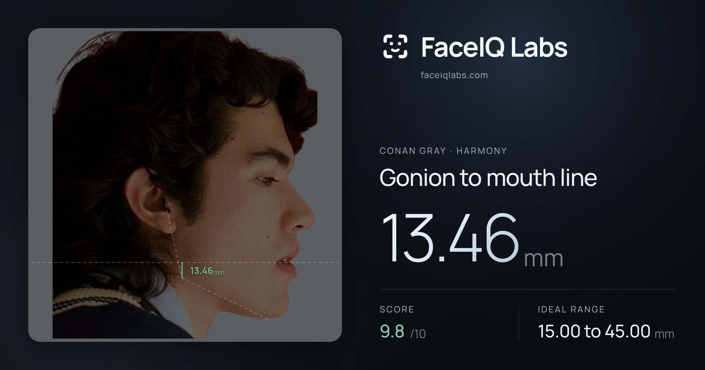 Conan Gray Gonion to mouth line: 13.46mm, drawn on the photo