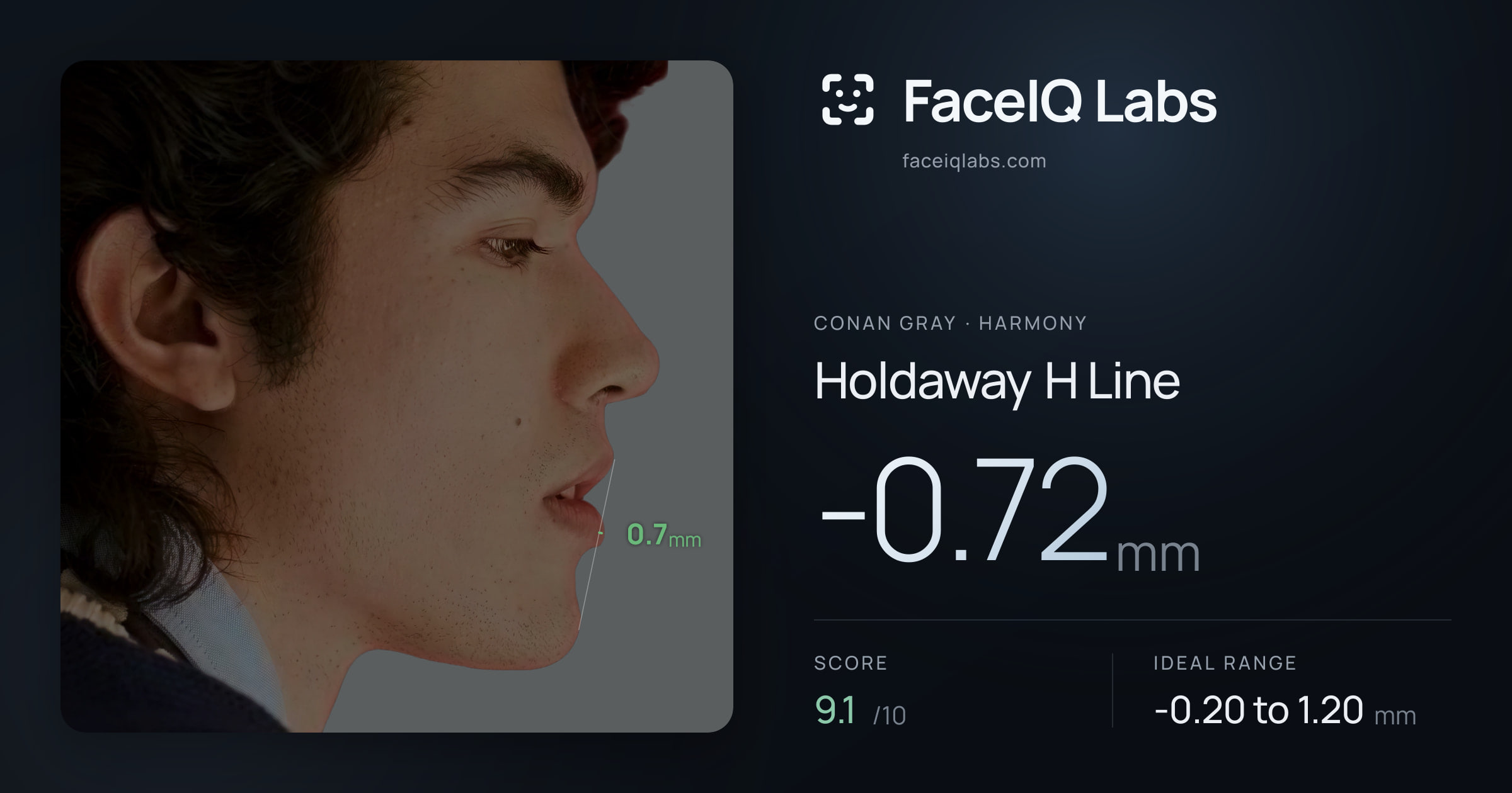 Conan Gray Holdaway H Line: -0.72mm, drawn on the photo