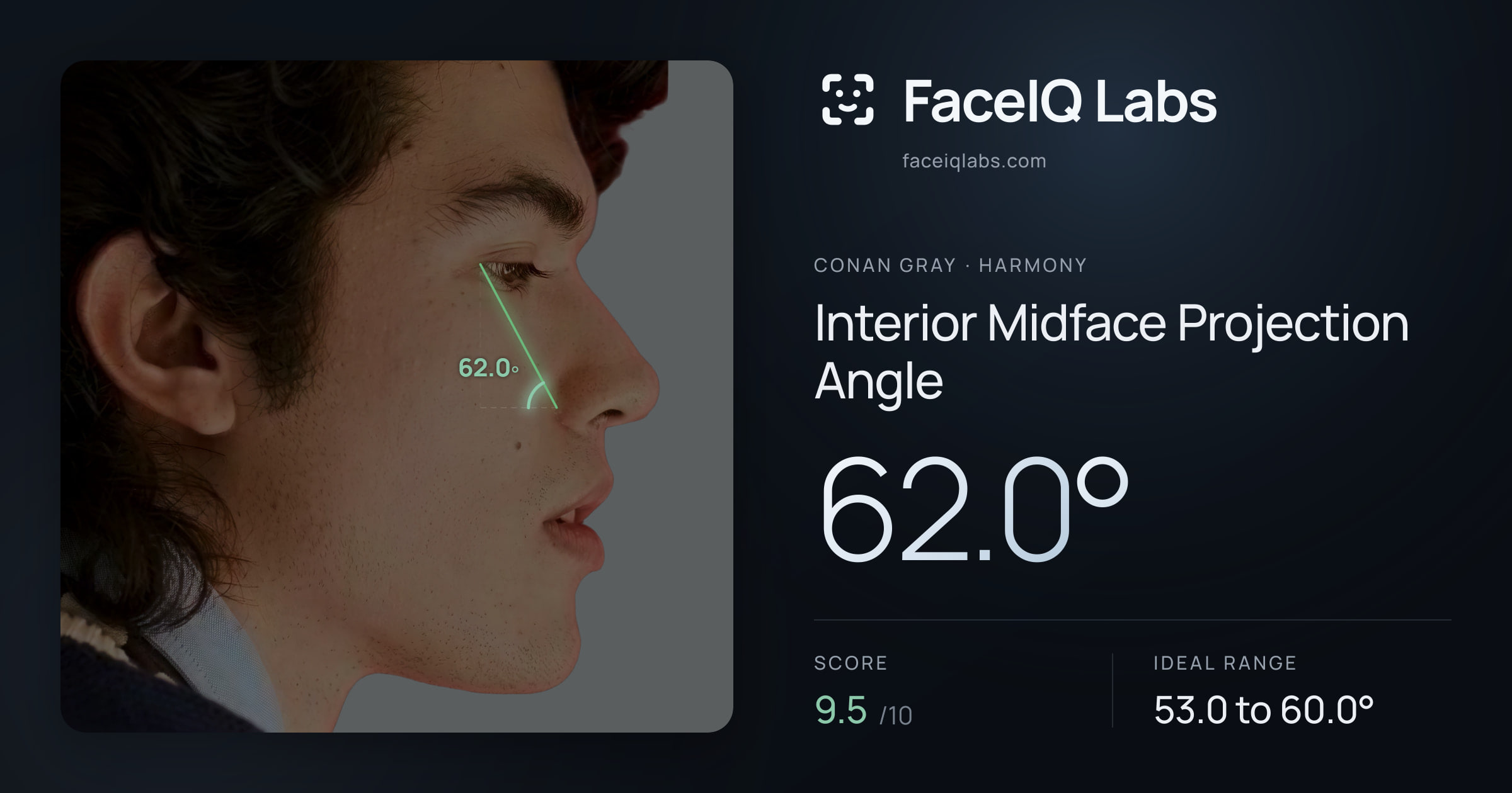 Conan Gray Interior Midface Projection Angle: 62.0°, drawn on the photo