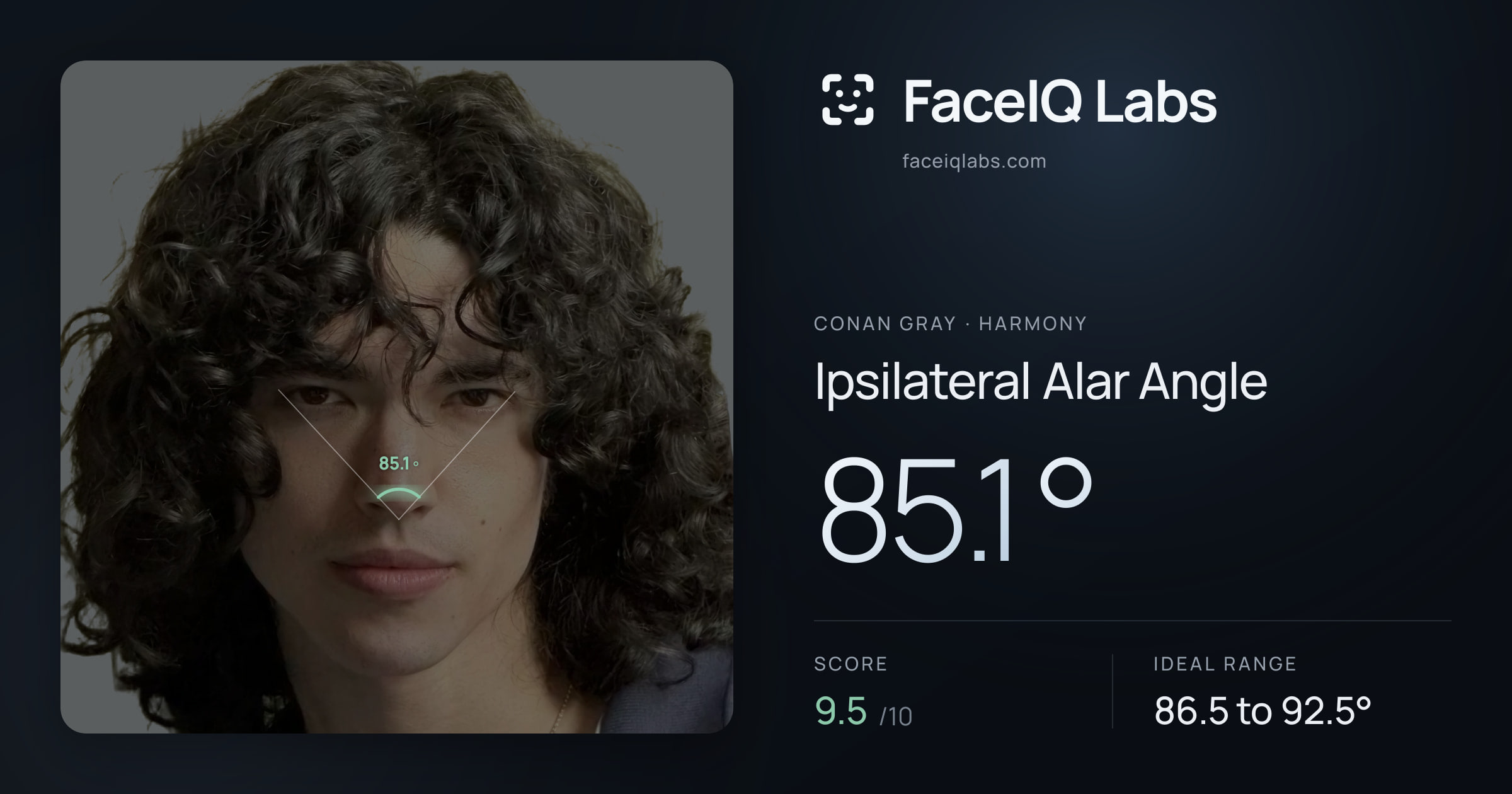 Conan Gray Ipsilateral Alar Angle: 85.1°, drawn on the photo