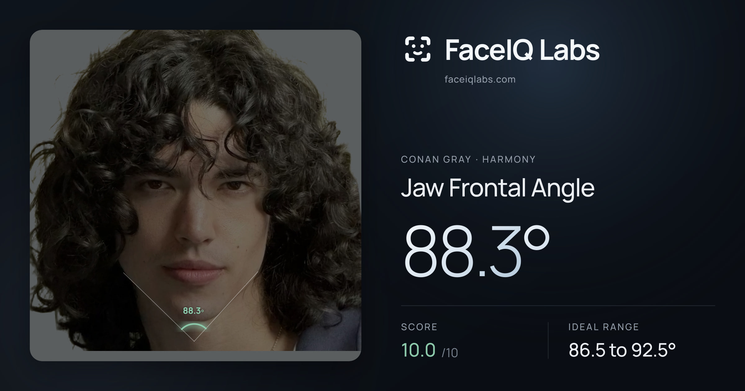 Conan Gray Jaw Frontal Angle: 88.3°, drawn on the photo