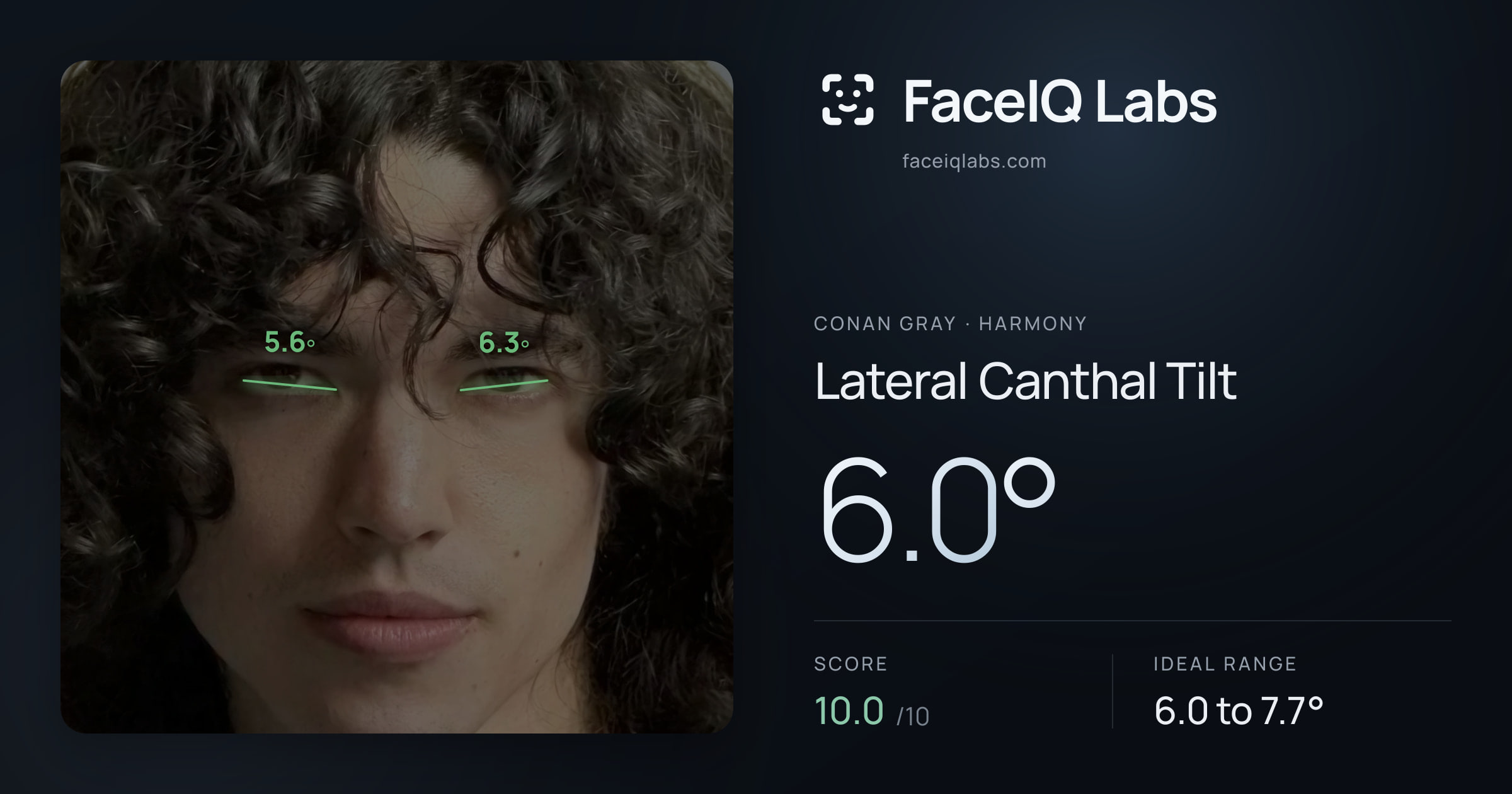 Conan Gray Lateral Canthal Tilt: 6.0°, drawn on the photo