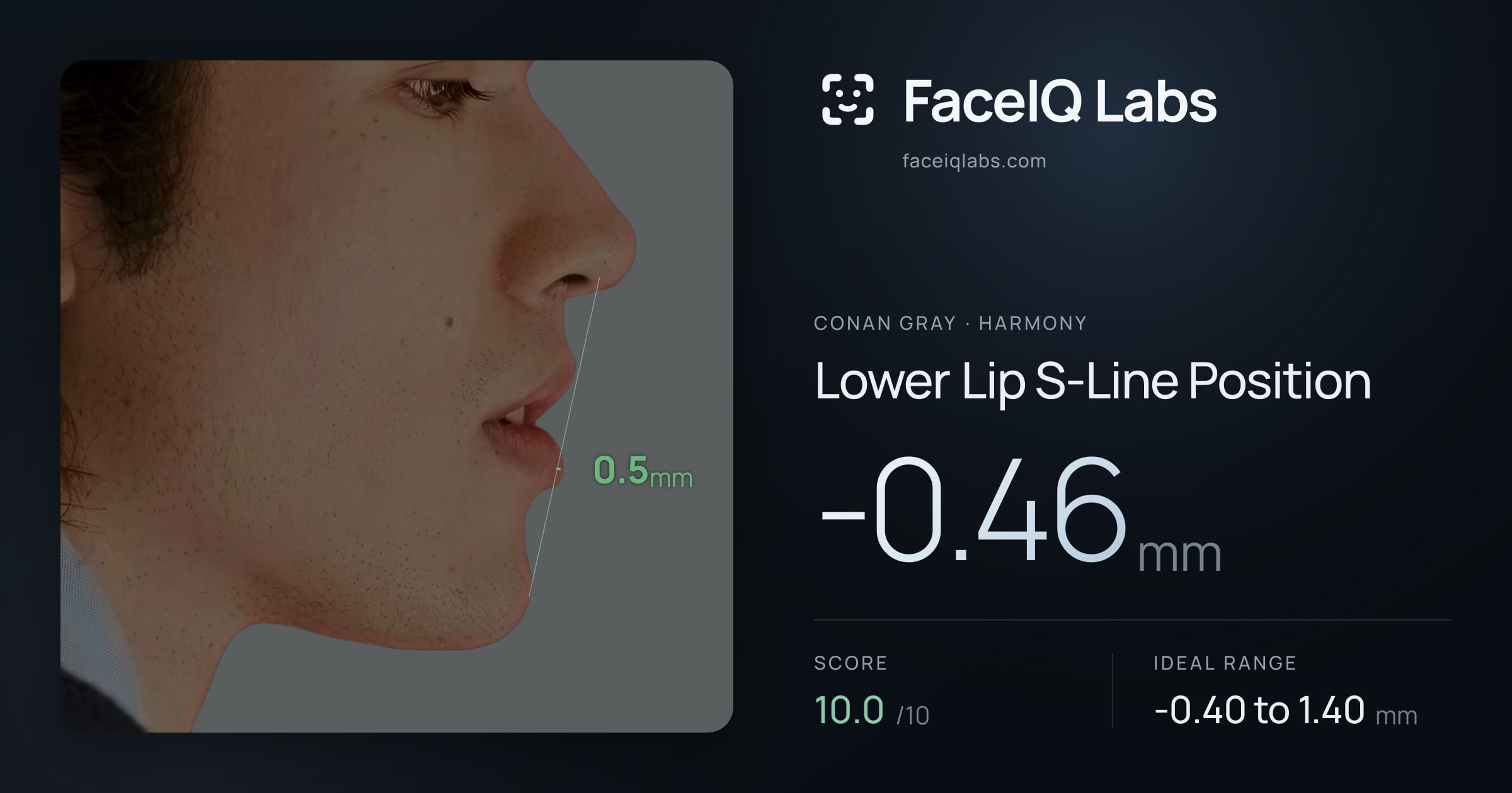 Conan Gray Lower Lip S-Line Position: -0.46mm, drawn on the photo