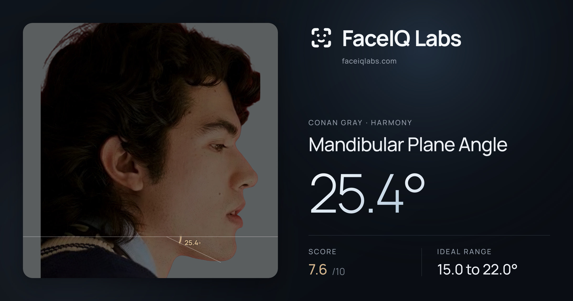 Conan Gray Mandibular Plane Angle: 25.4°, drawn on the photo
