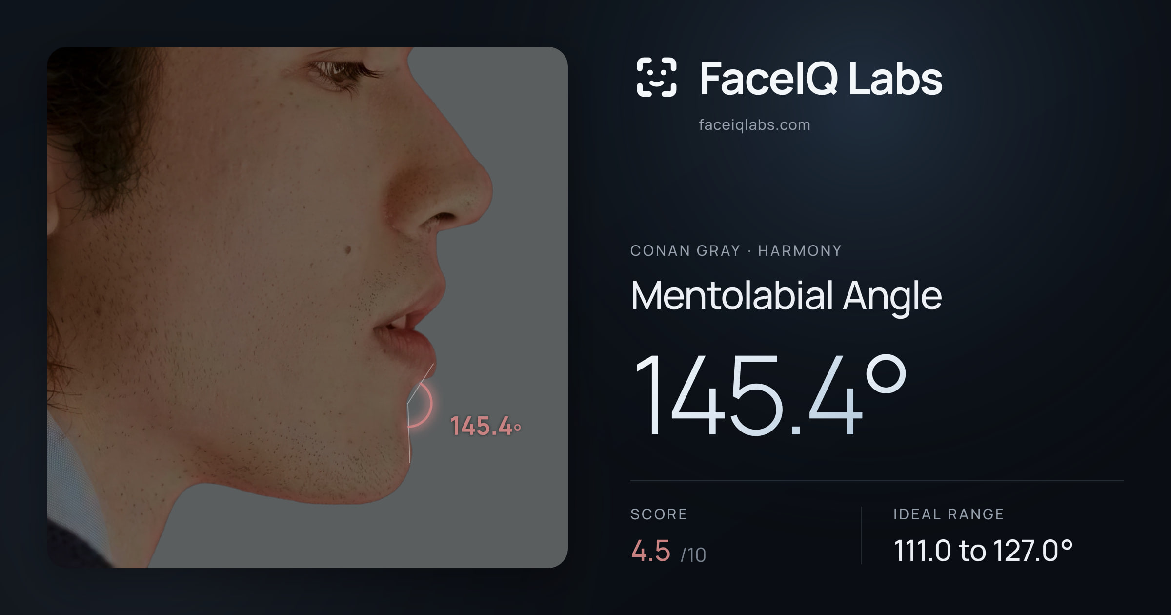 Conan Gray Mentolabial Angle: 145.4°, drawn on the photo