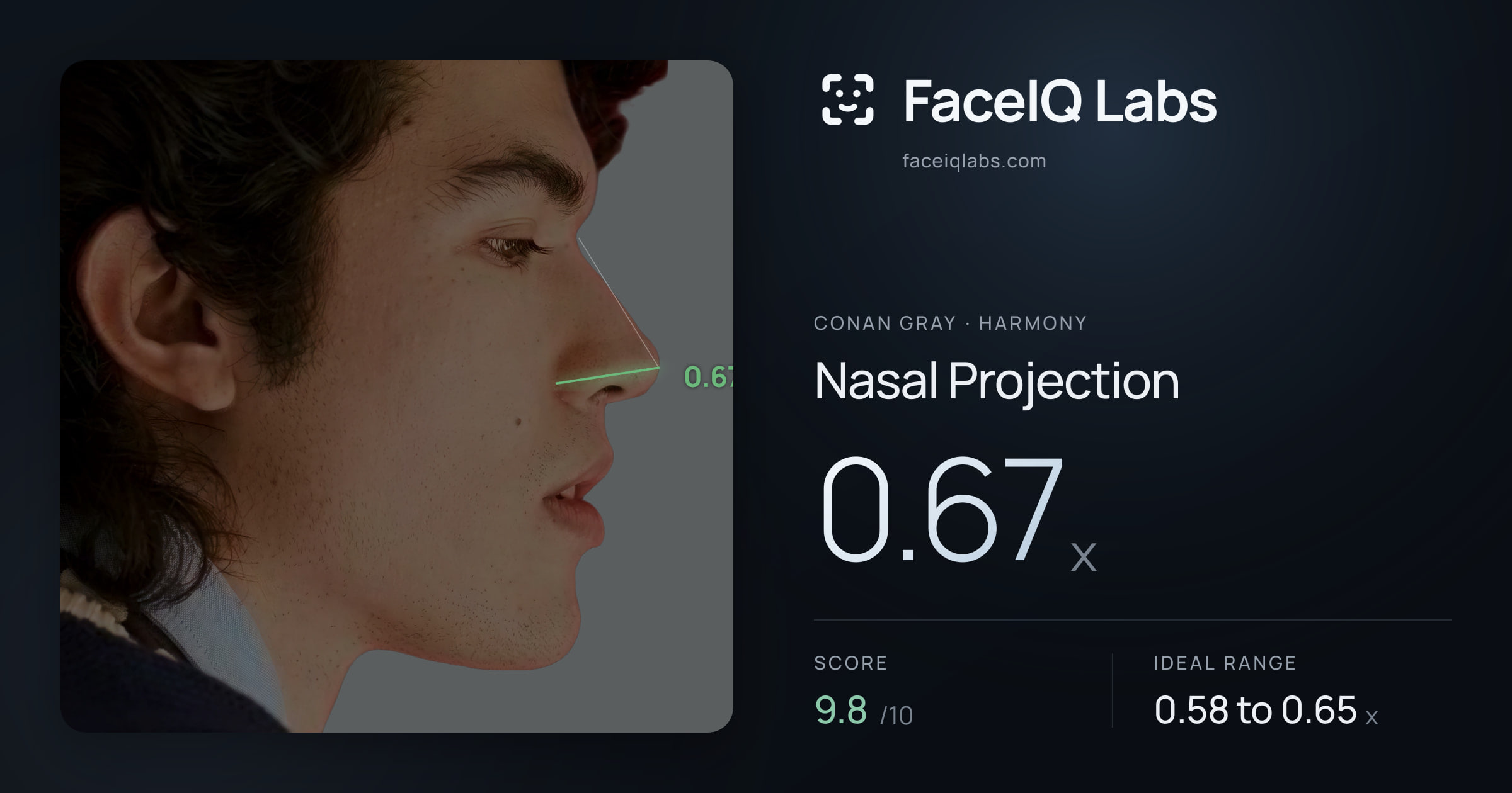 Conan Gray Nasal Projection: 0.67x, drawn on the photo