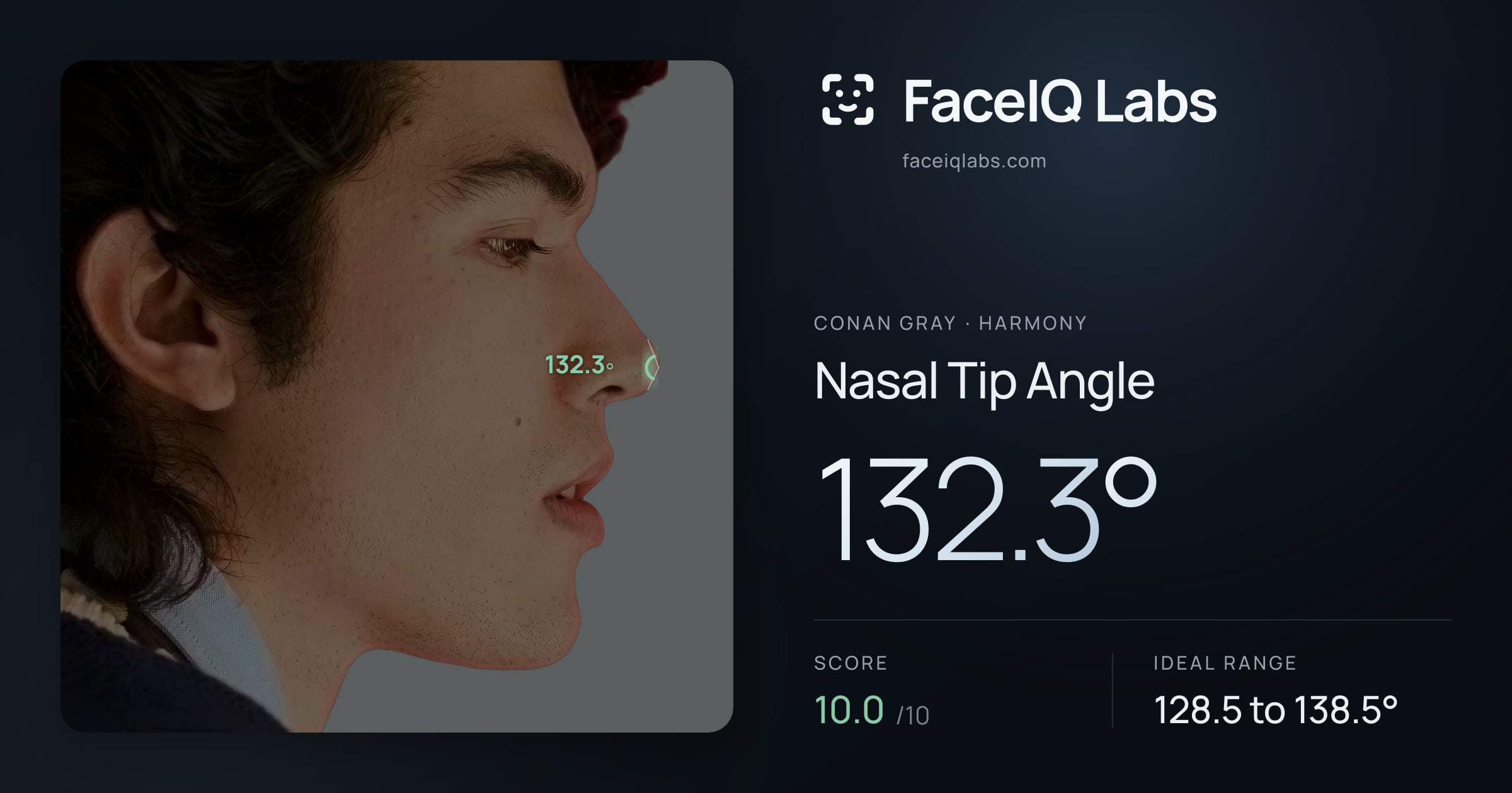Conan Gray Nasal Tip Angle: 132.3°, drawn on the photo