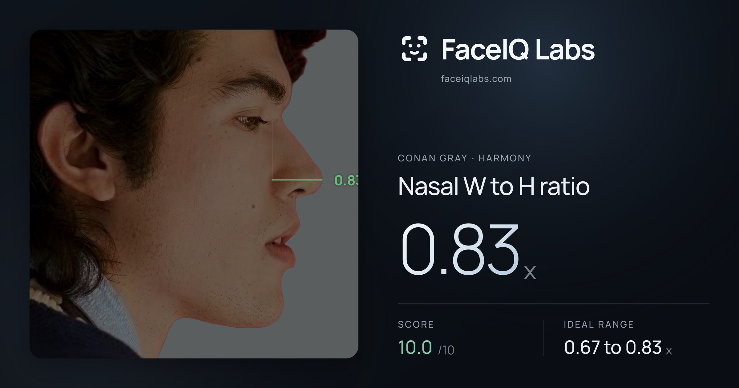 Conan Gray Nasal W to H ratio: 0.83x, drawn on the photo
