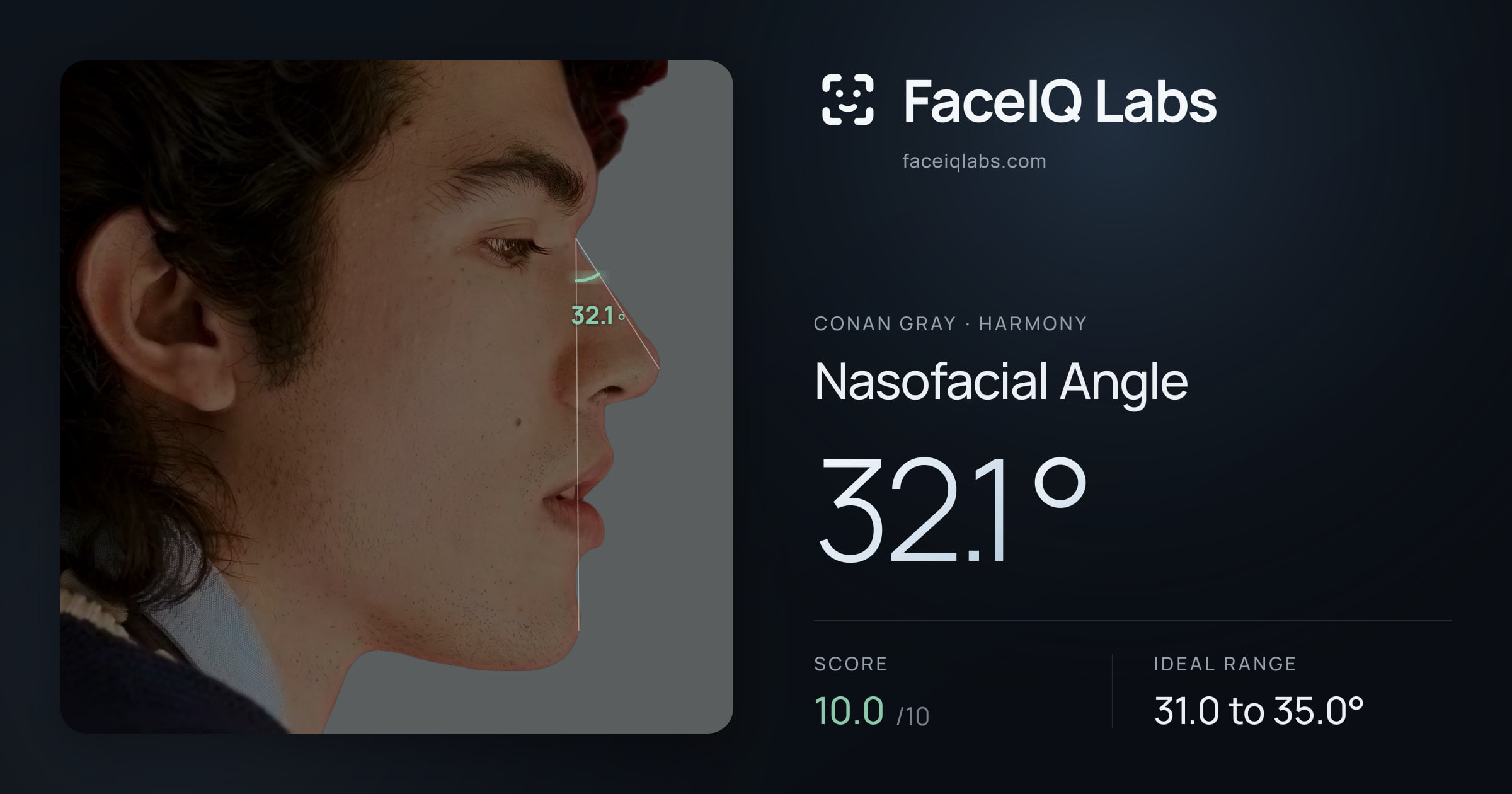 Conan Gray Nasofacial Angle: 32.1°, drawn on the photo