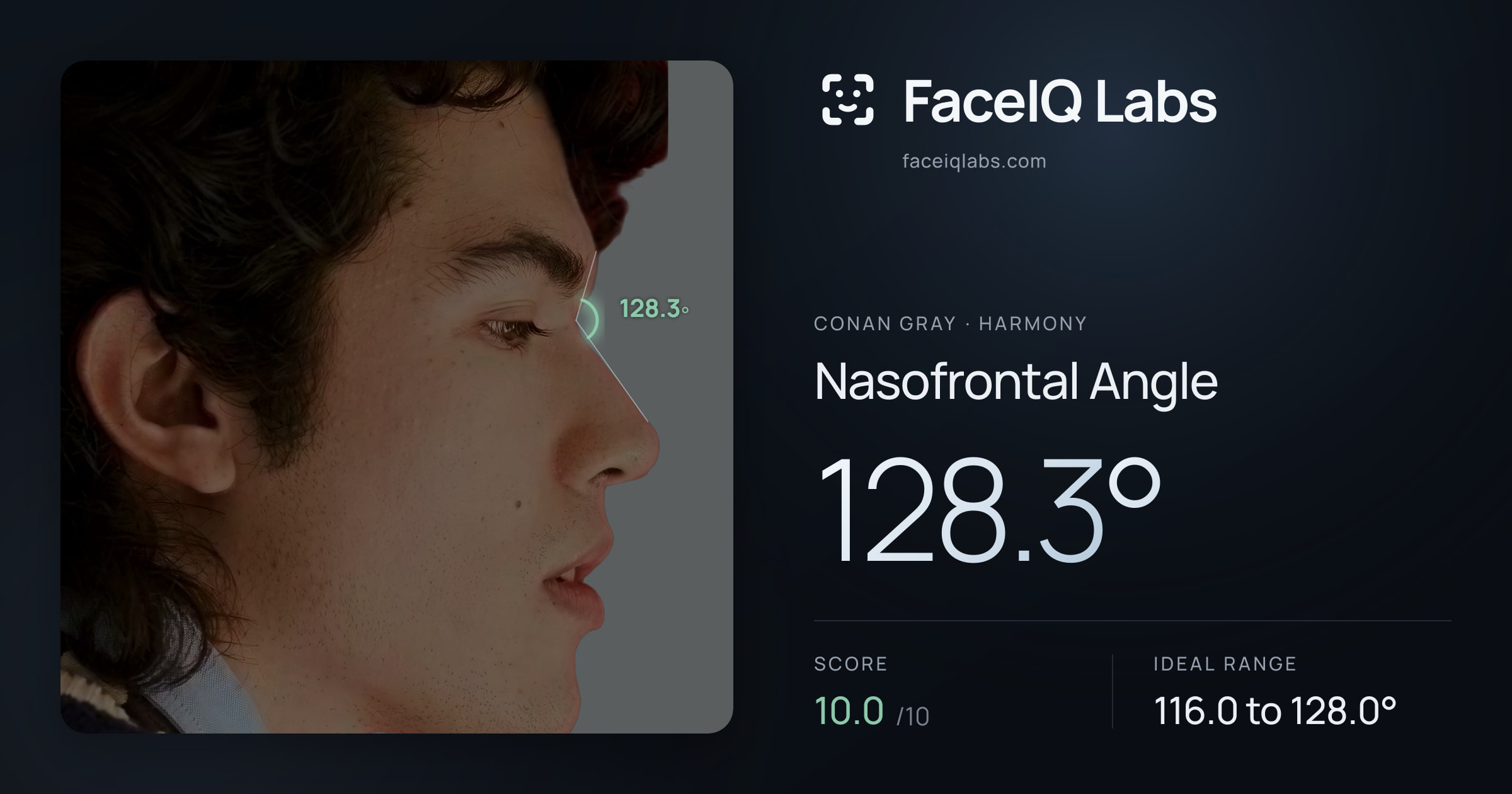 Conan Gray Nasofrontal Angle: 128.3°, drawn on the photo