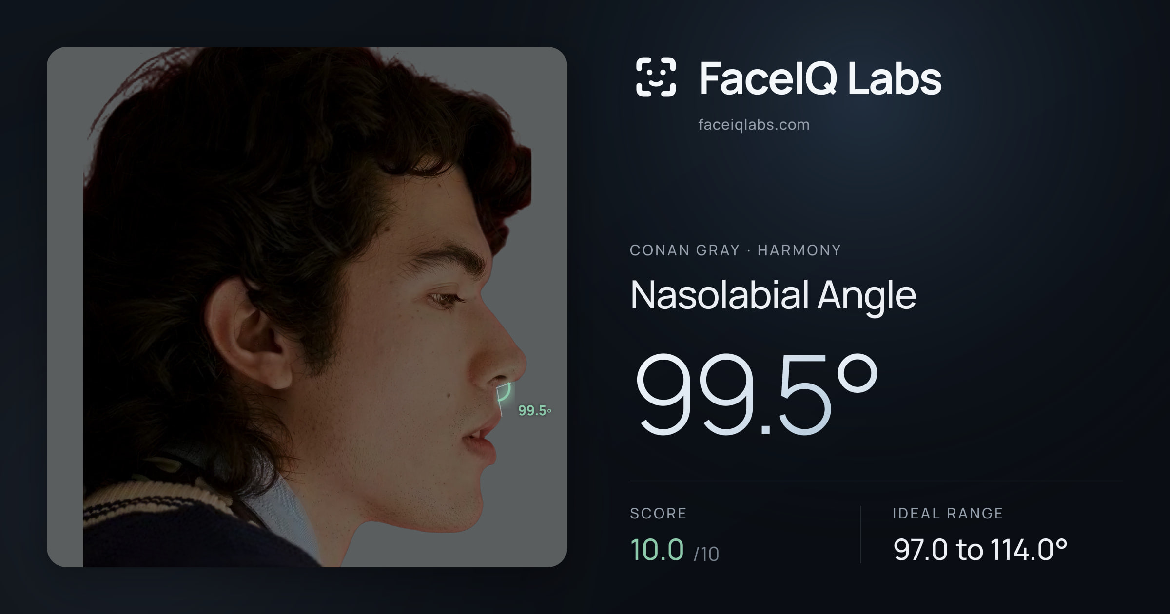 Conan Gray Nasolabial Angle: 99.5°, drawn on the photo