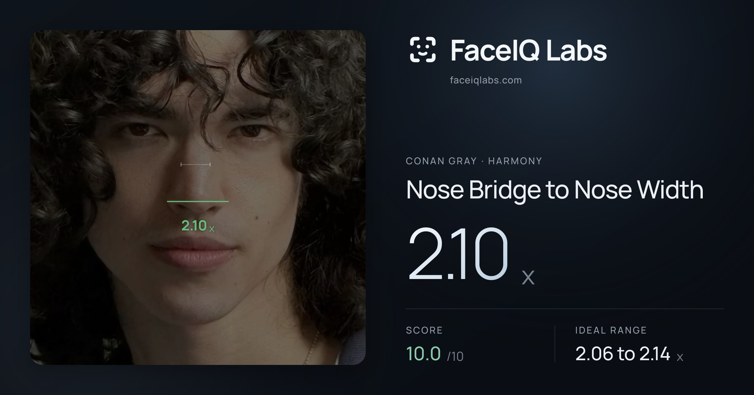 Conan Gray Nose Bridge to Nose Width: 2.10x, drawn on the photo