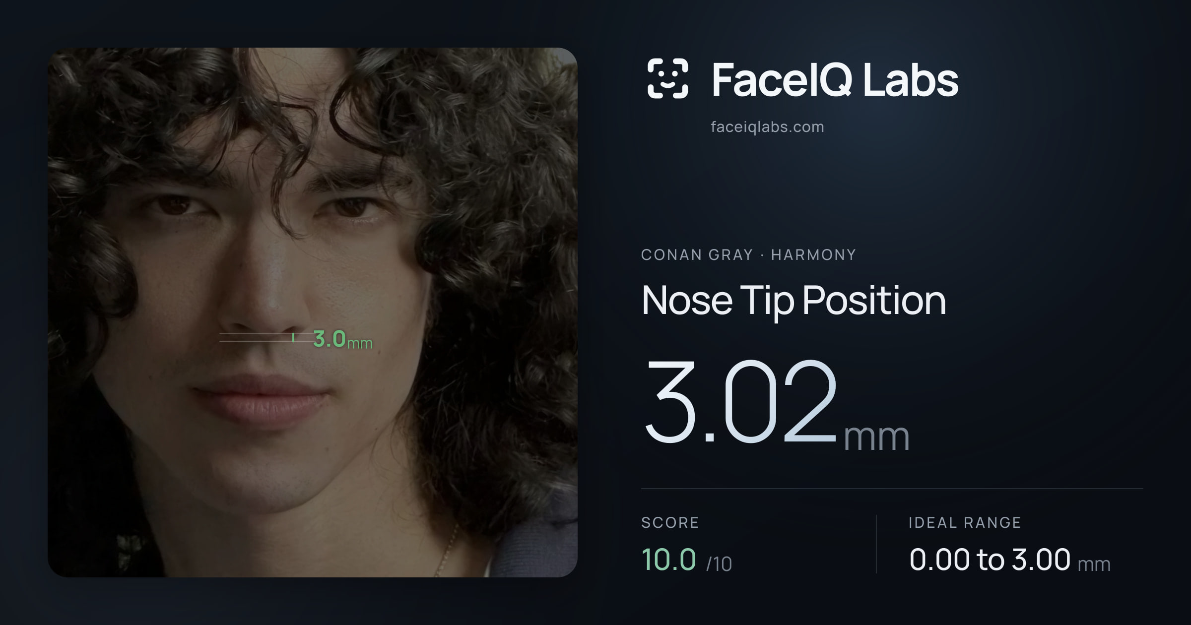 Conan Gray Nose Tip Position: 3.02mm, drawn on the photo
